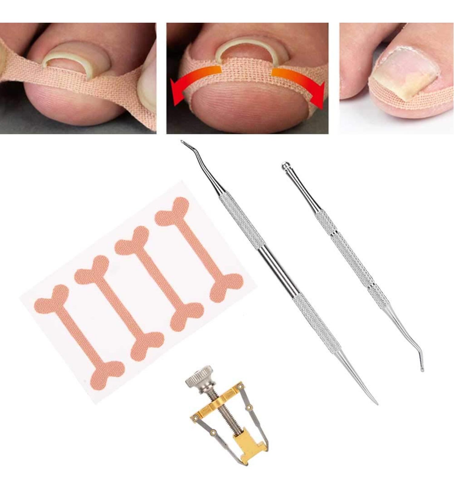 Professional Toenail Correction Tool Set - Steel Nail Corrector Voter & File for Perfect Toenails - Buy Online on GoSupps.com