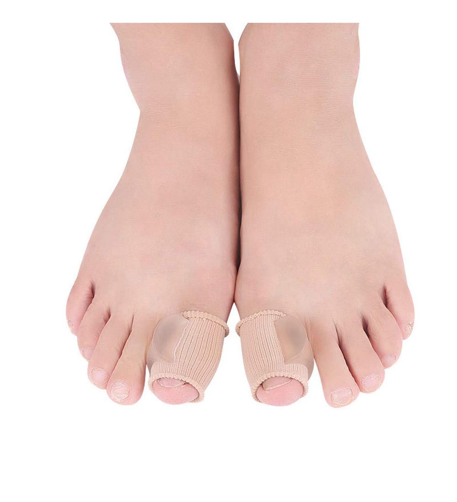 Shoes Valgus Big Toe Splitter Wear Separator Thumb Valgus Thumb Corrector Can Foot Care Famous Feet Callous Remover 1 Fl Oz (Pack of 1) A