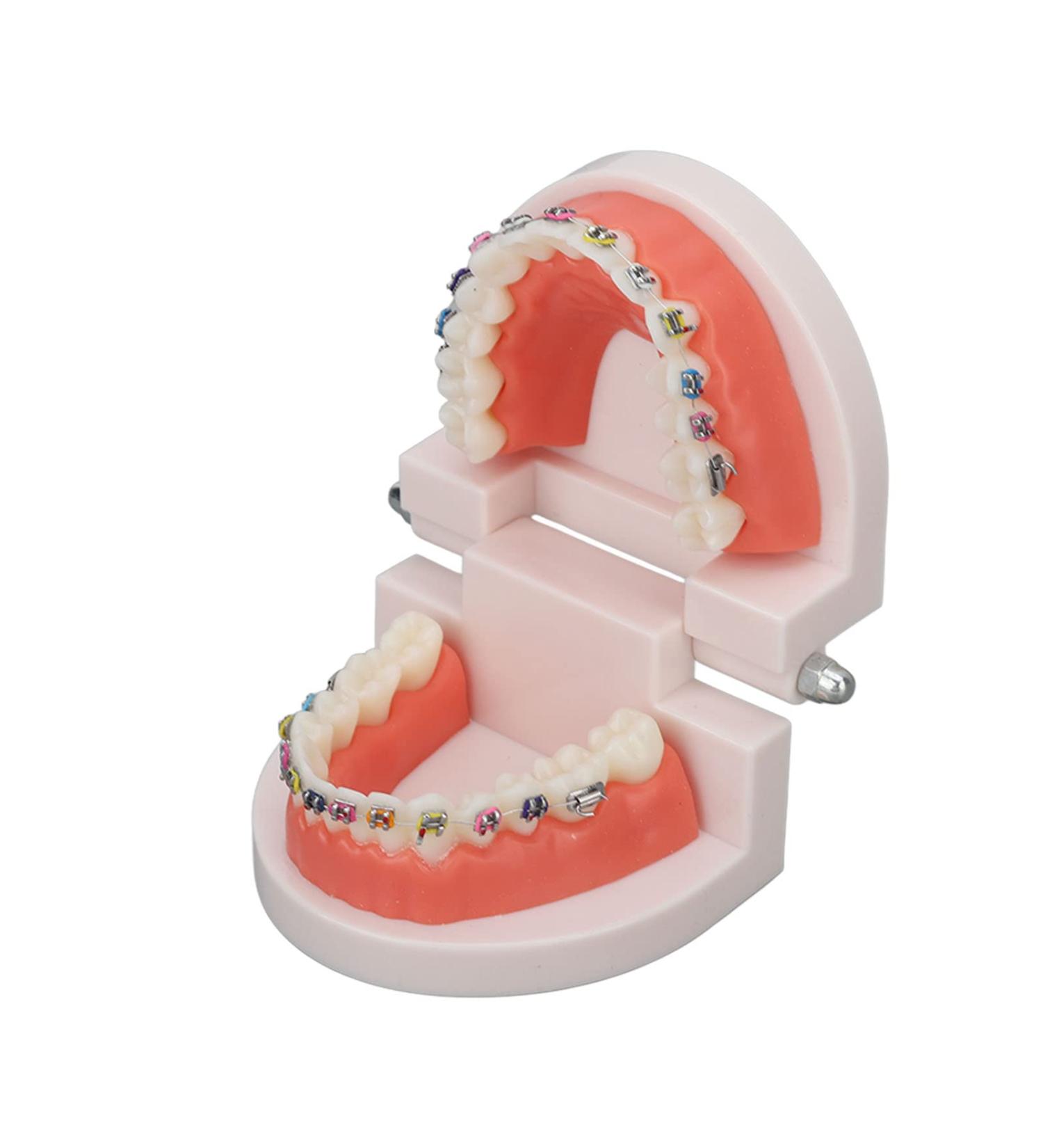 Orthodontic Tooth Model with Metal Brackets - Ideal for Teaching & Research in Laboratories | International Shipping - Buy Online on GoSupps.com