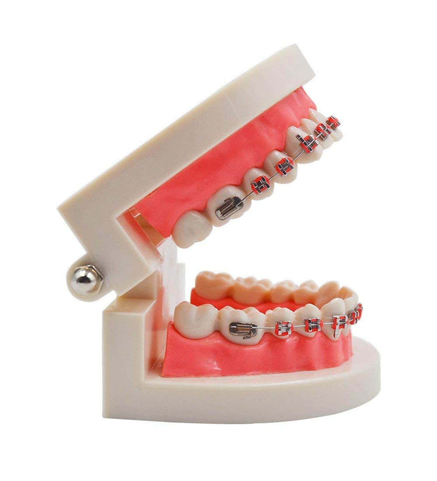 KFO Tooth Model Standard Tooth Teaching Malocclusion KFO Teeth Model with Brackets Archwire Tools - Buy Online on GoSupps.com