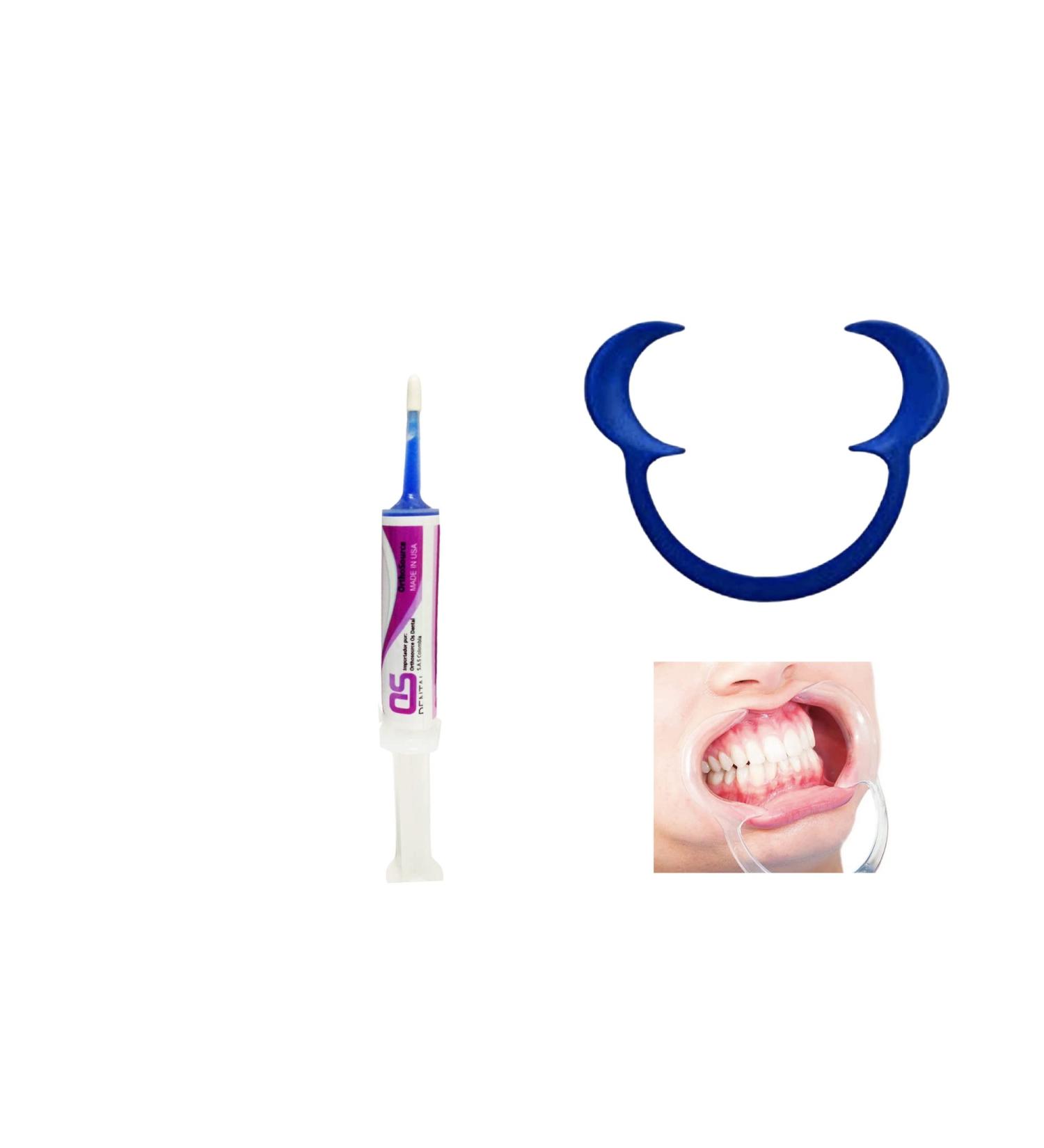 SmileWorld Blue Gel 35% Desmineralization Kit with Lip Expander - Dental Etch for Precision - Viscous Formula - Made in USA (3 Units) - Buy Online on GoSupps.com