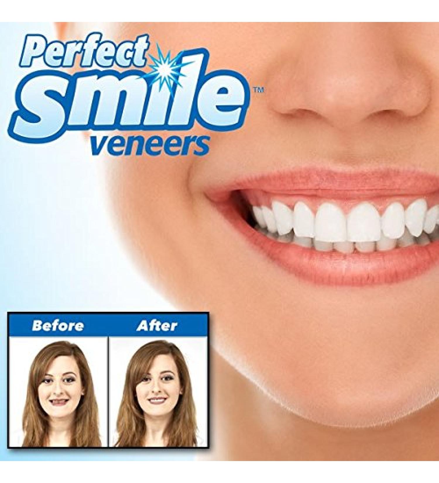 Instant Perfect Smile Kit | SHOP-STORY Replacement Tooth - Reusable & Removable | International Shipping Available - Buy Online on GoSupps.com