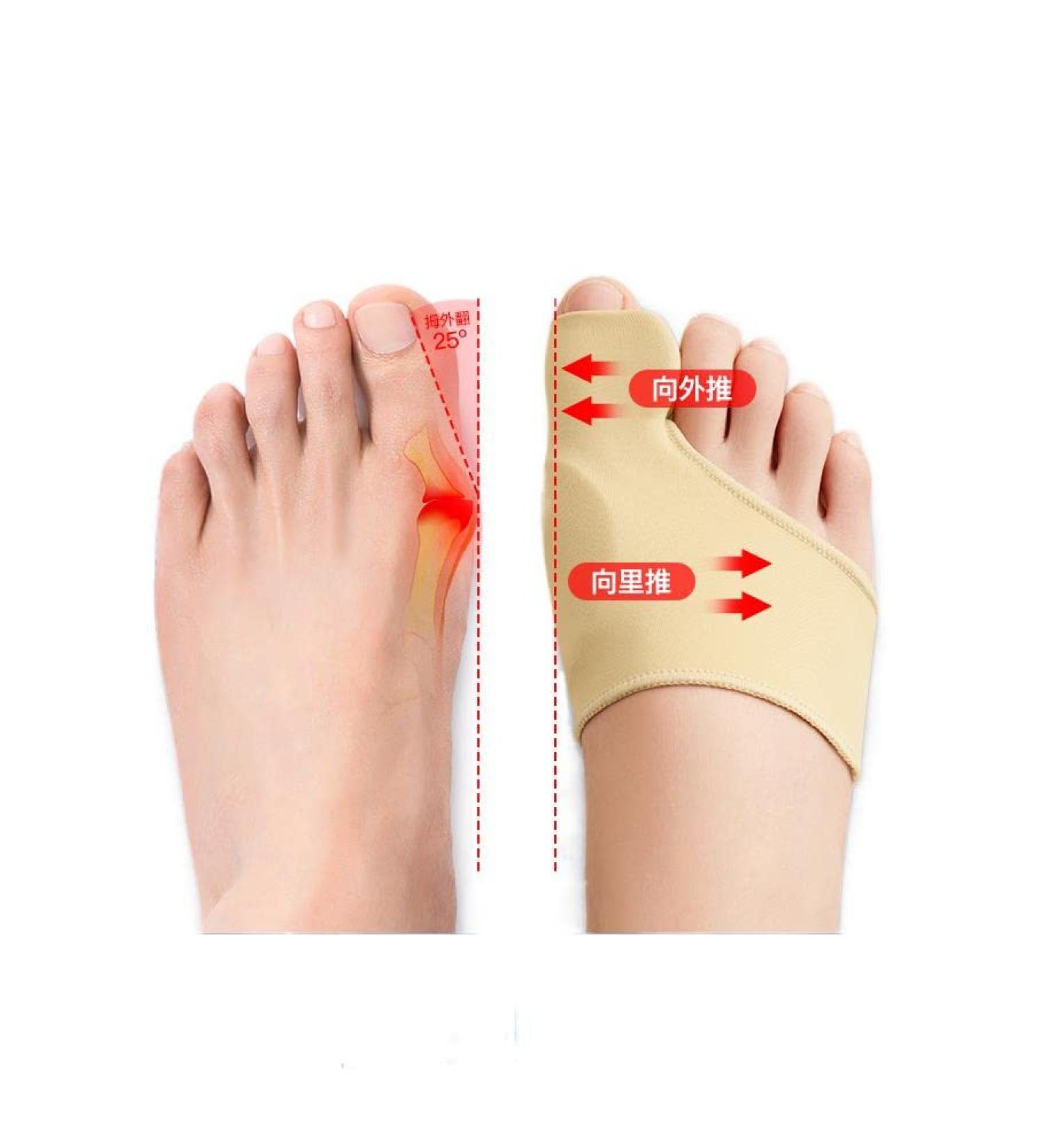 Big Toe Valgus Corrector - Relieve Pain and Align Toe Naturally - Buy Online on GoSupps.com