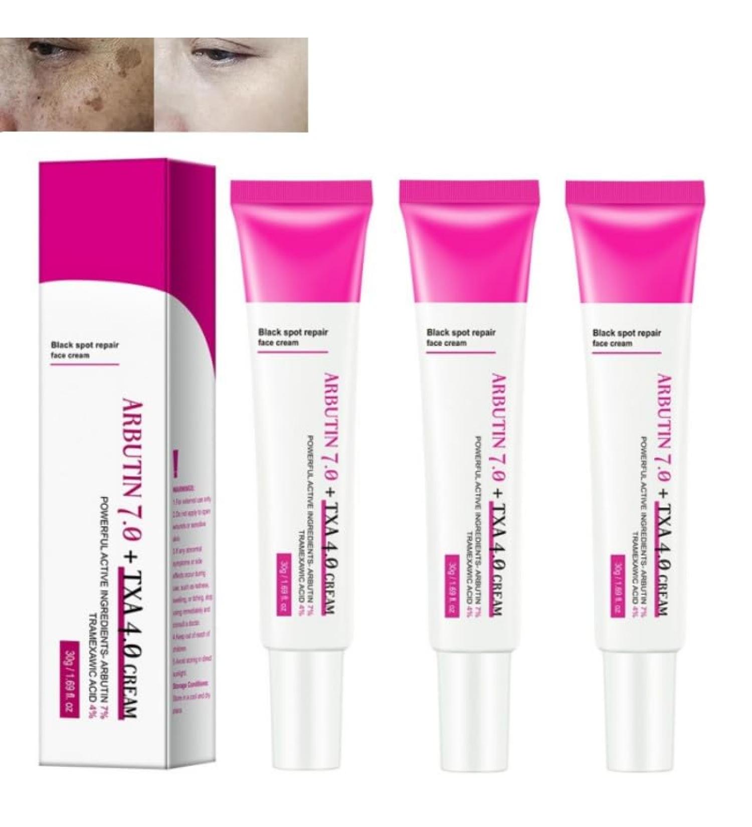 3PCS*30G Crema para Manchas en La Cara Cremas para la manchas de la cara crema para aclarar la piel Face Moisturizing cream - Buy Online on GoSupps.com