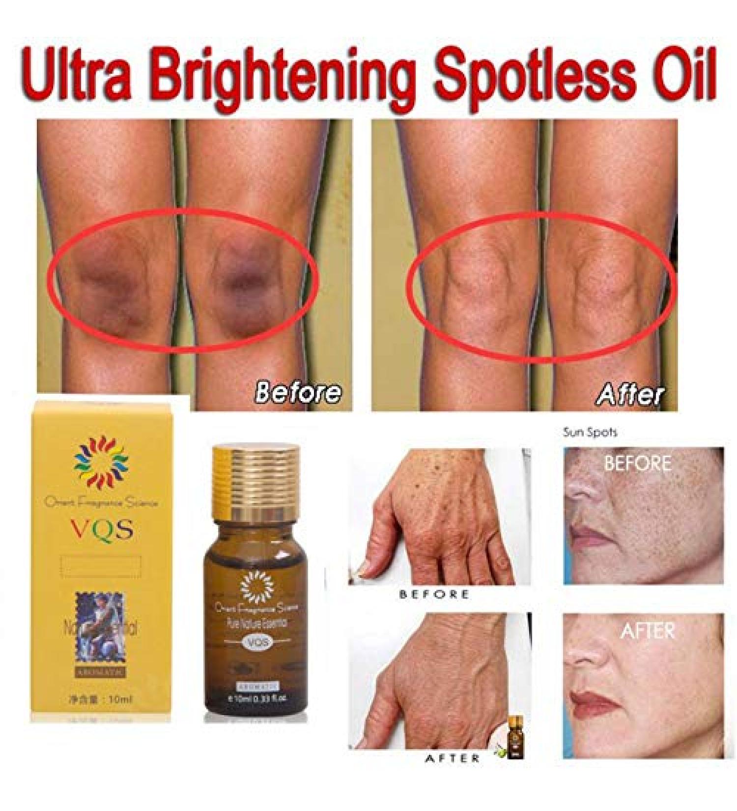 Woya Whitening Essential Oil for Face Remove Dark Spots Brightening Whitening Anti-Aging Nourishing Essence (1PC) - Buy Online on GoSupps.com