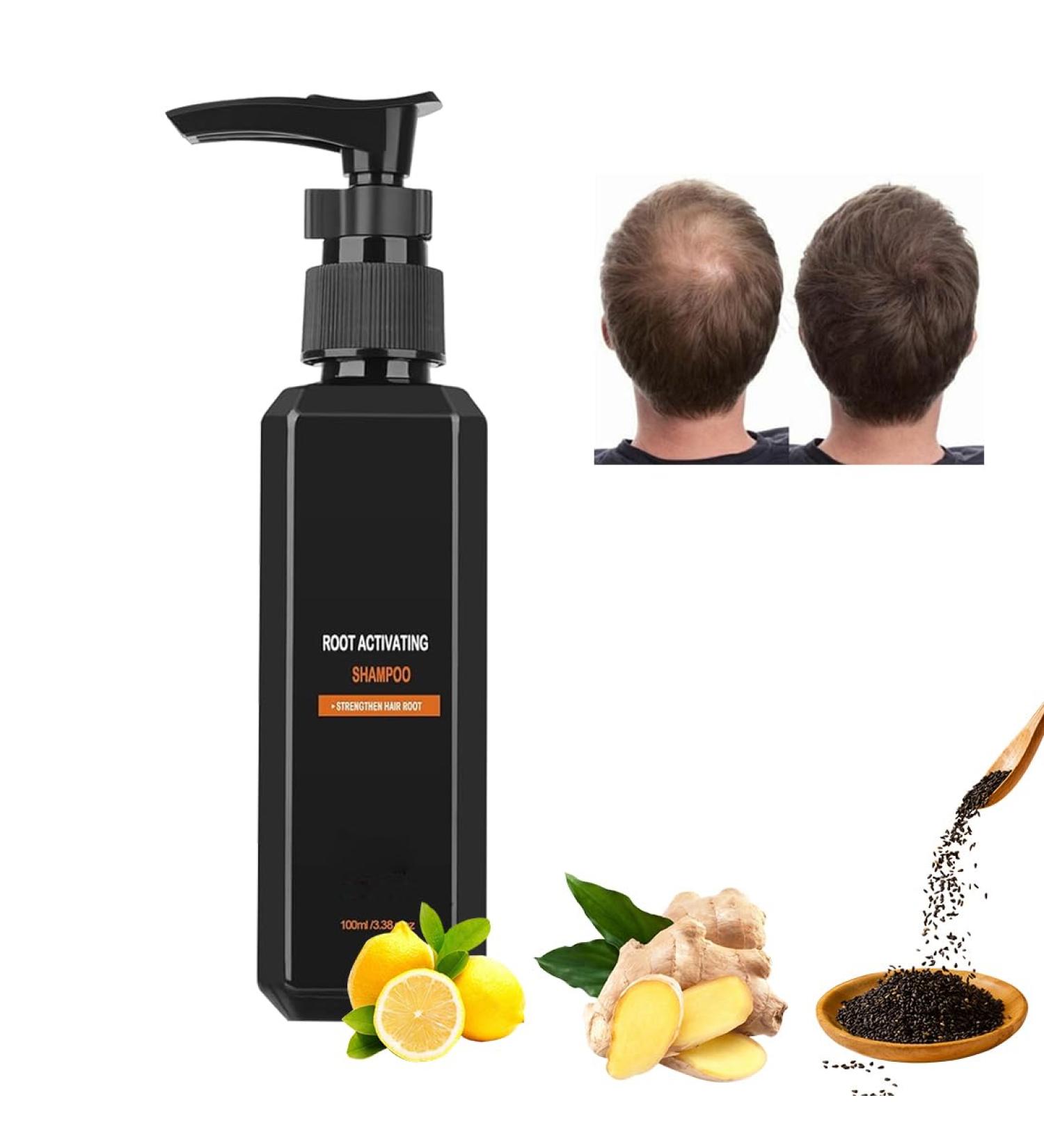  Aethryon hair growth shampoo root activating shampoo hair loss repair shampoo hair growth shampoo hair loss shampoo - Buy Online on GoSupps.com