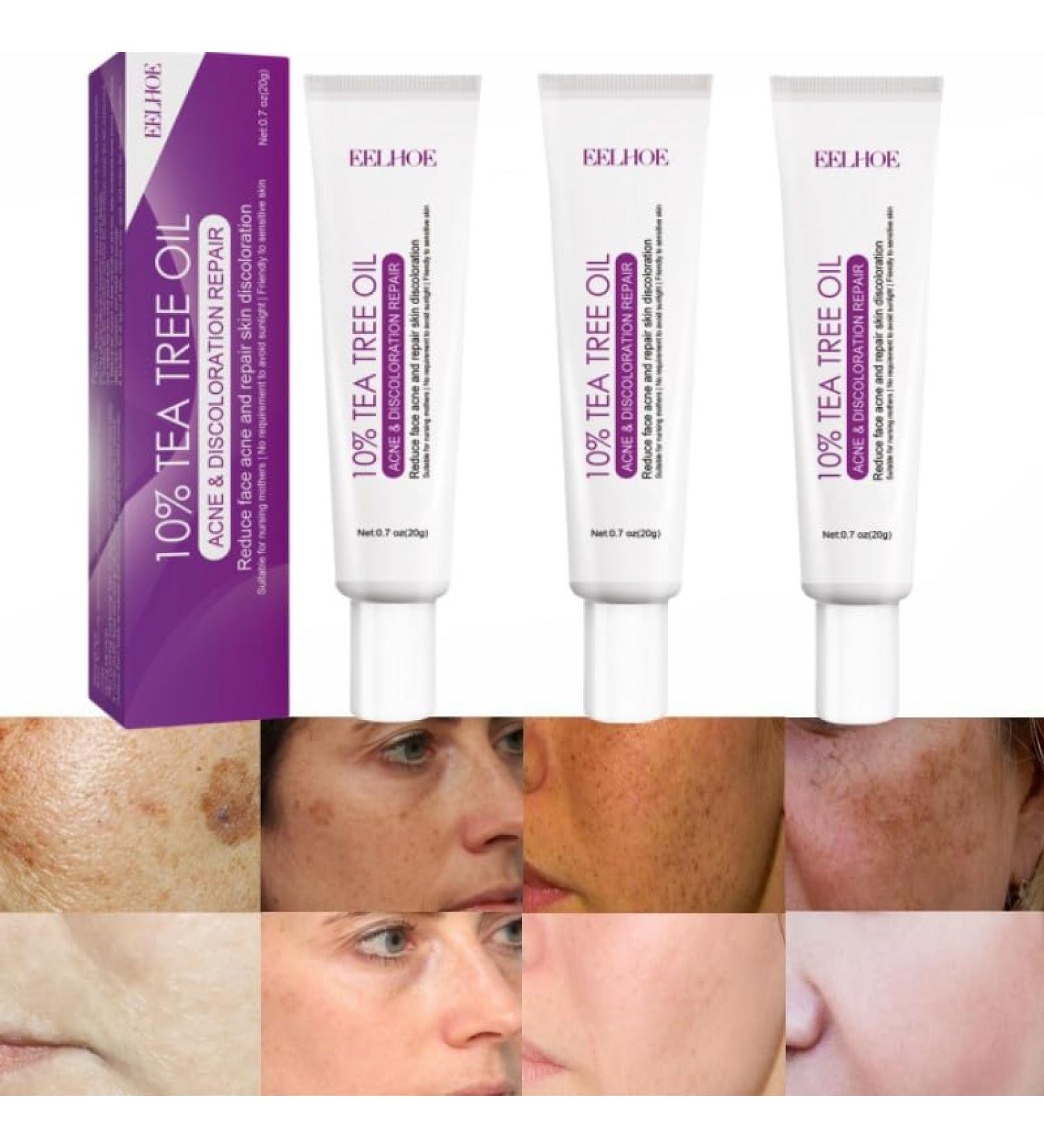 Lot de 3 cr mes pour Las Manchas de La Cara Cremas para Quitar Manchas de La Cara Crema Blanqueadora para Pecas Elimina el Melasma Manchas Oscuras Aclara La Piel - Buy Online on GoSupps.com