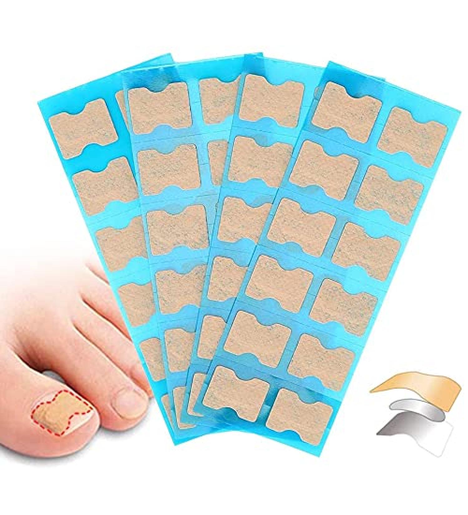 Toenail Correction Patch - Glue-Free Ingrown Toenail Sticker | 72 Pieces | Pedicure Tool for Men & Women - Buy Online on GoSupps.com