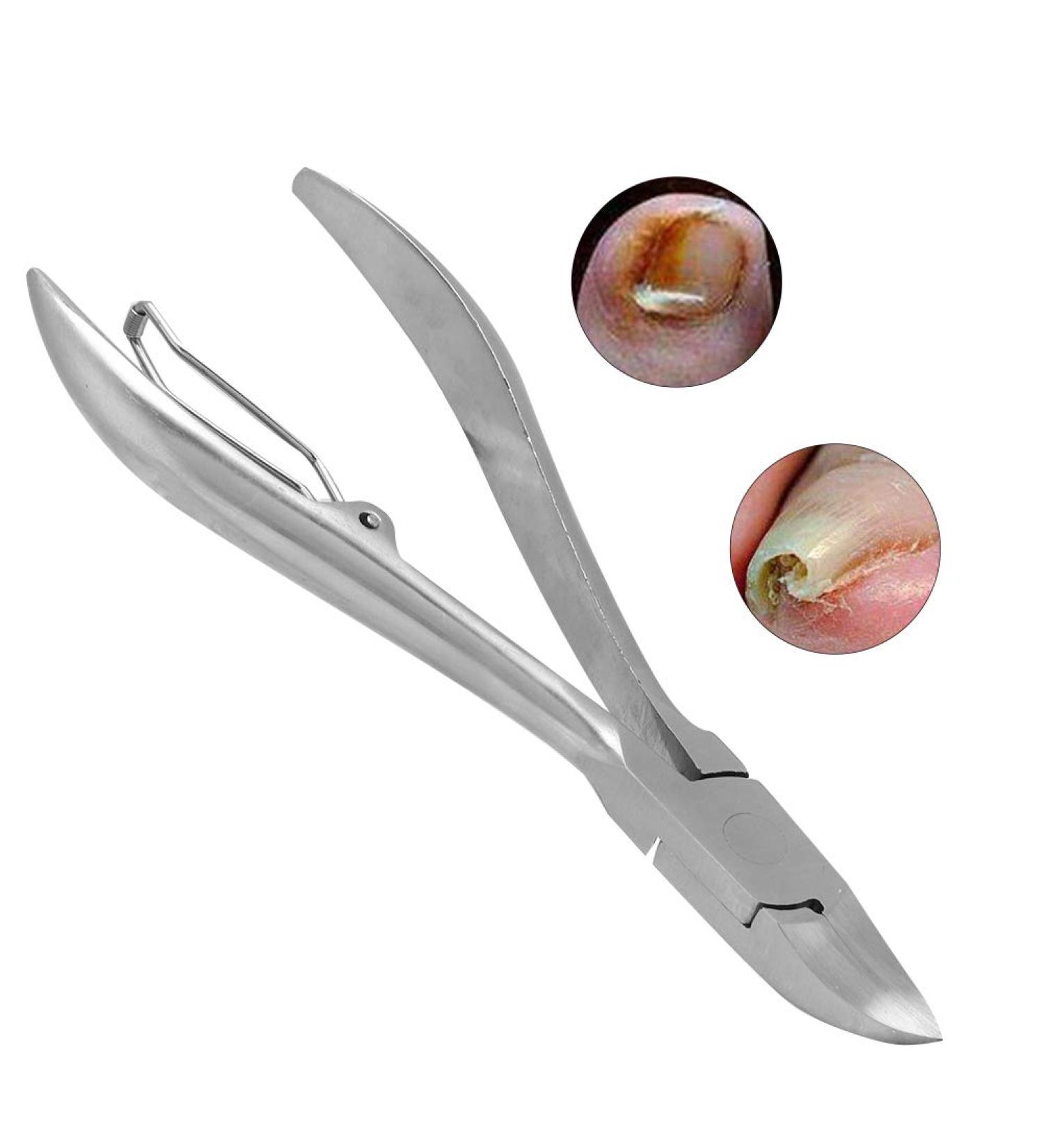 Stainless Steel Cuticle Nippers Thick Nail Trimmer for Paronychia Treatment - Buy Online on GoSupps.com