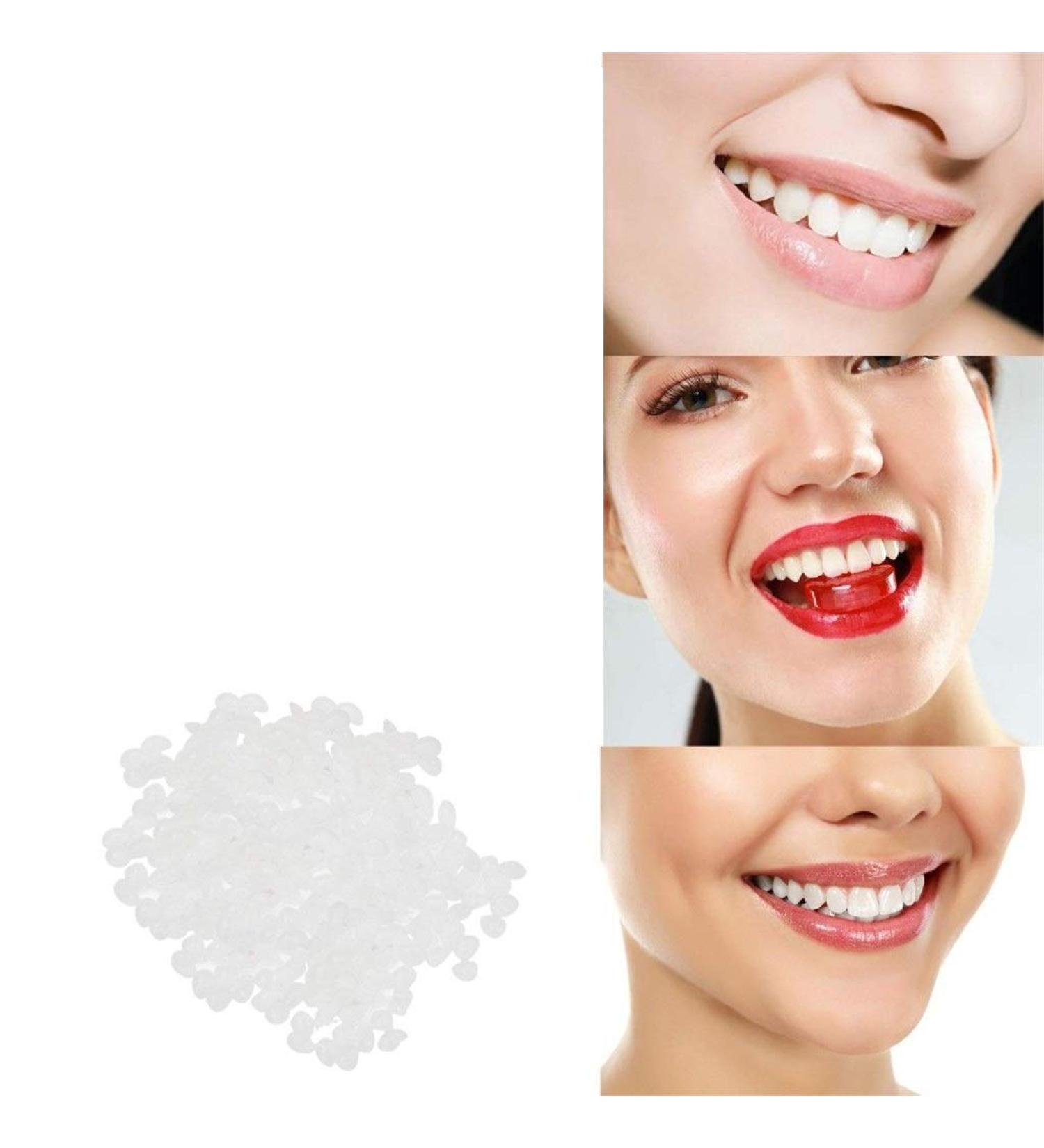 Adh sif pour proth ses en colle pour le remplacement des dents d fectueuses R paration dentaire Dents en r sine synth tique temporaires et fentes Faux dents Colle solide(5 grammes) - Buy Online on GoSupps.com