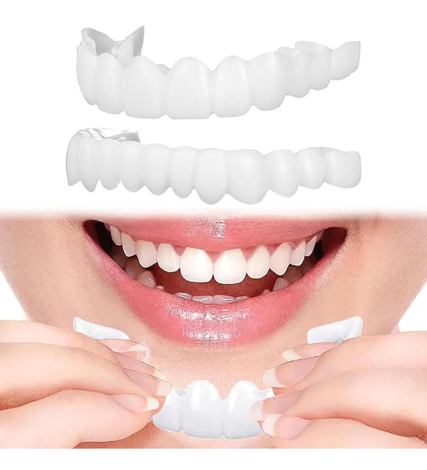 Brigtviee False Teeth 2 Pairs ClipIn Veneer Teeth Instant Perfect Smile Teeth Veneer Top and Bottom Set Temporary Cosmetic Fake Teeth Comfort Fit Dentures for Bad Teeth Coverage - Buy Online on GoSupps.com