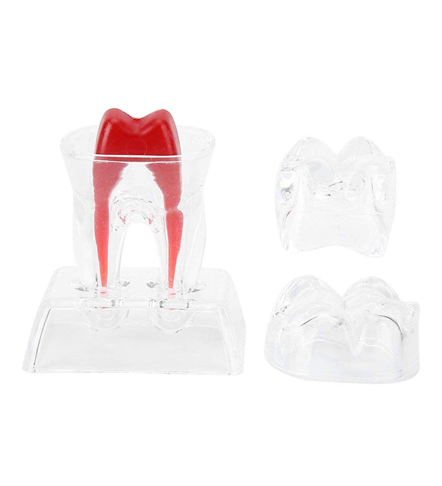 Discriminable Toothed Tooth Model for Endodontics | Plastic Teeth Teaching Material for Dental Studies & Research | International Shipping Available - Buy Online on GoSupps.com