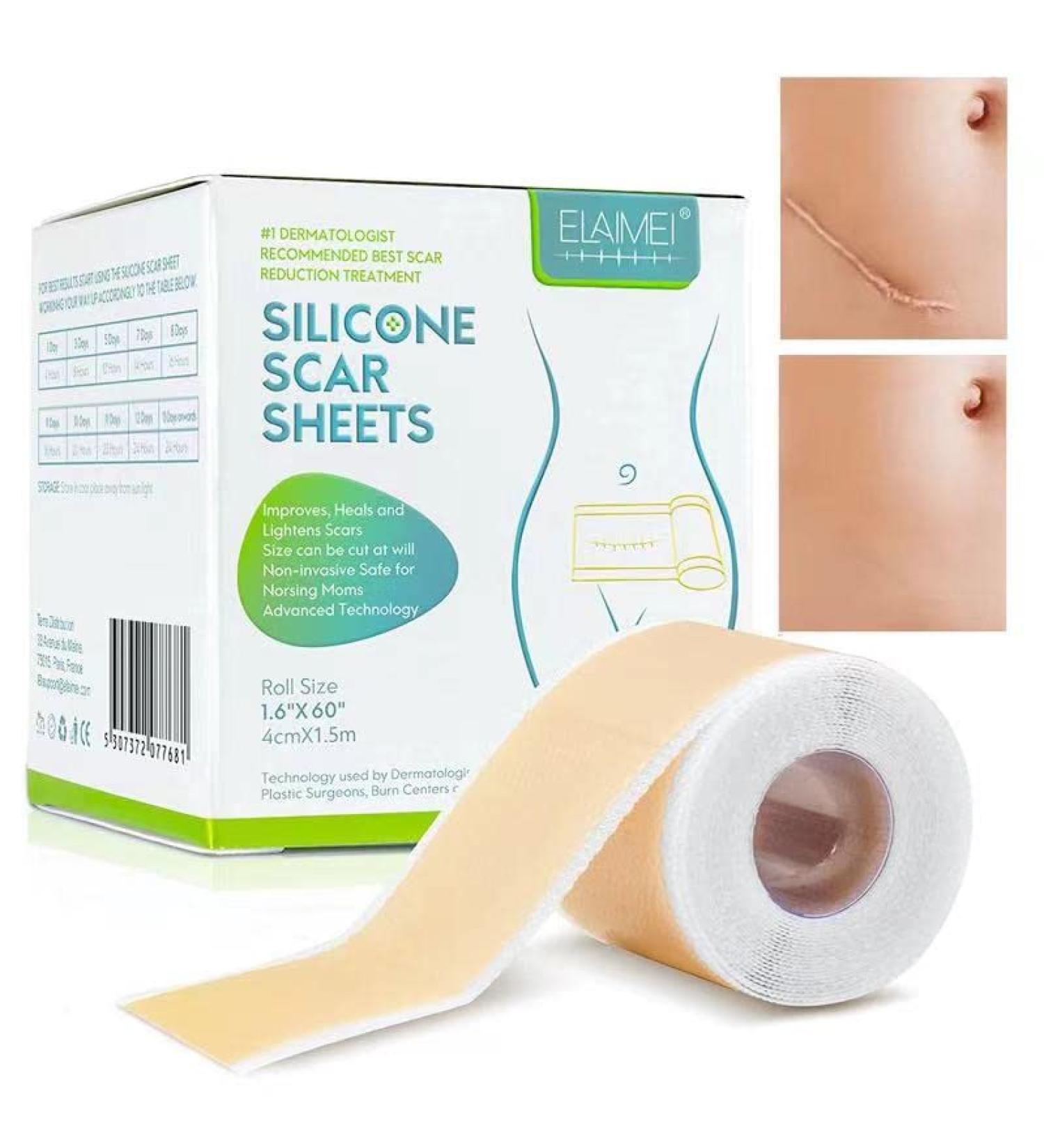 Silicone Scar Sheets 1.6 x 60 Roll - Effective Silicone Gel Tape for Scar Removal - C-Section, Keloid, Burn & Acne - 1.5M Roll - Buy Online on GoSupps.com
