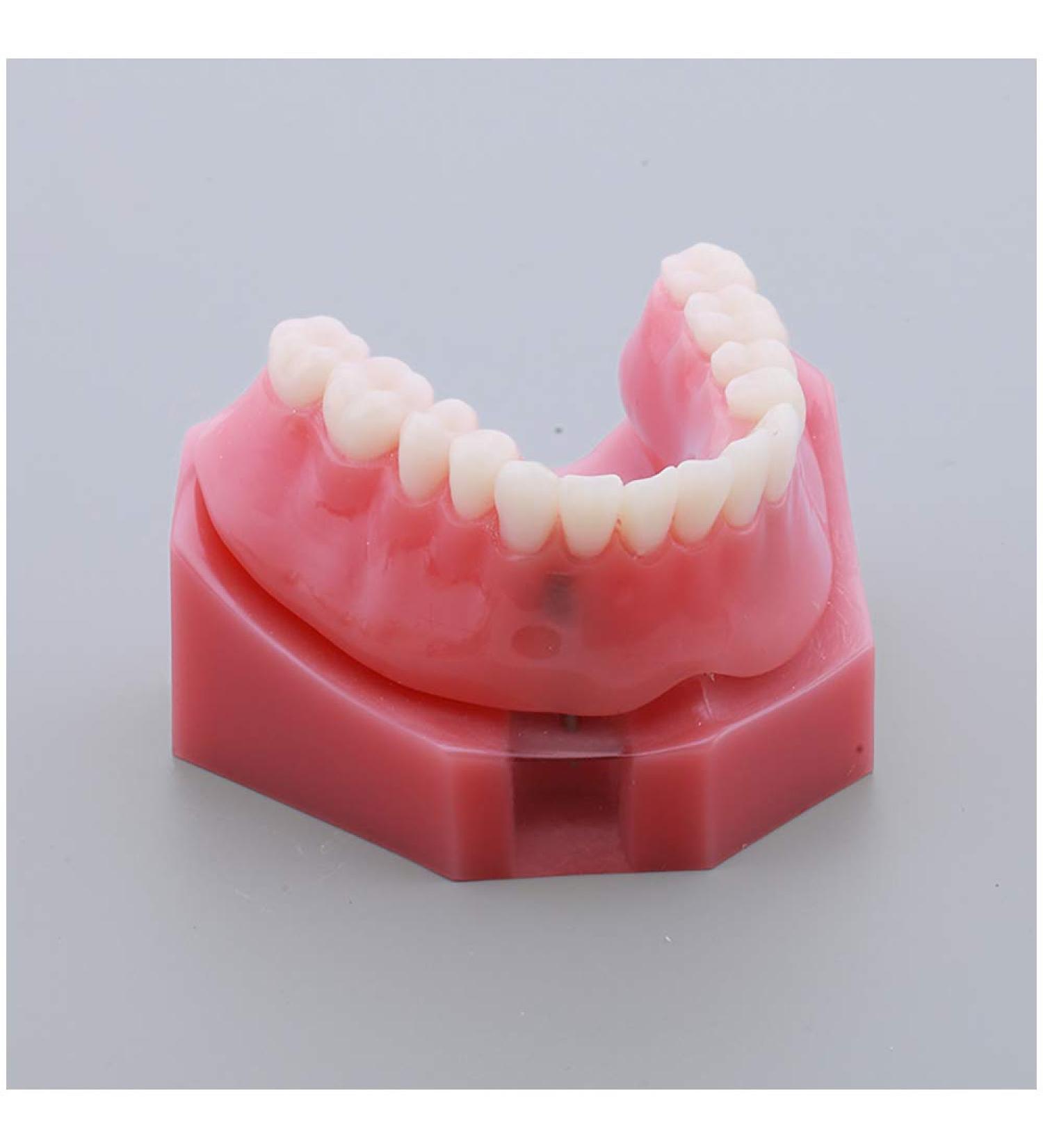Fhuili Teeth Model for Education | Dental Implant Repair & Communication | Red Dentition Simulation Tool - Buy Online on GoSupps.com