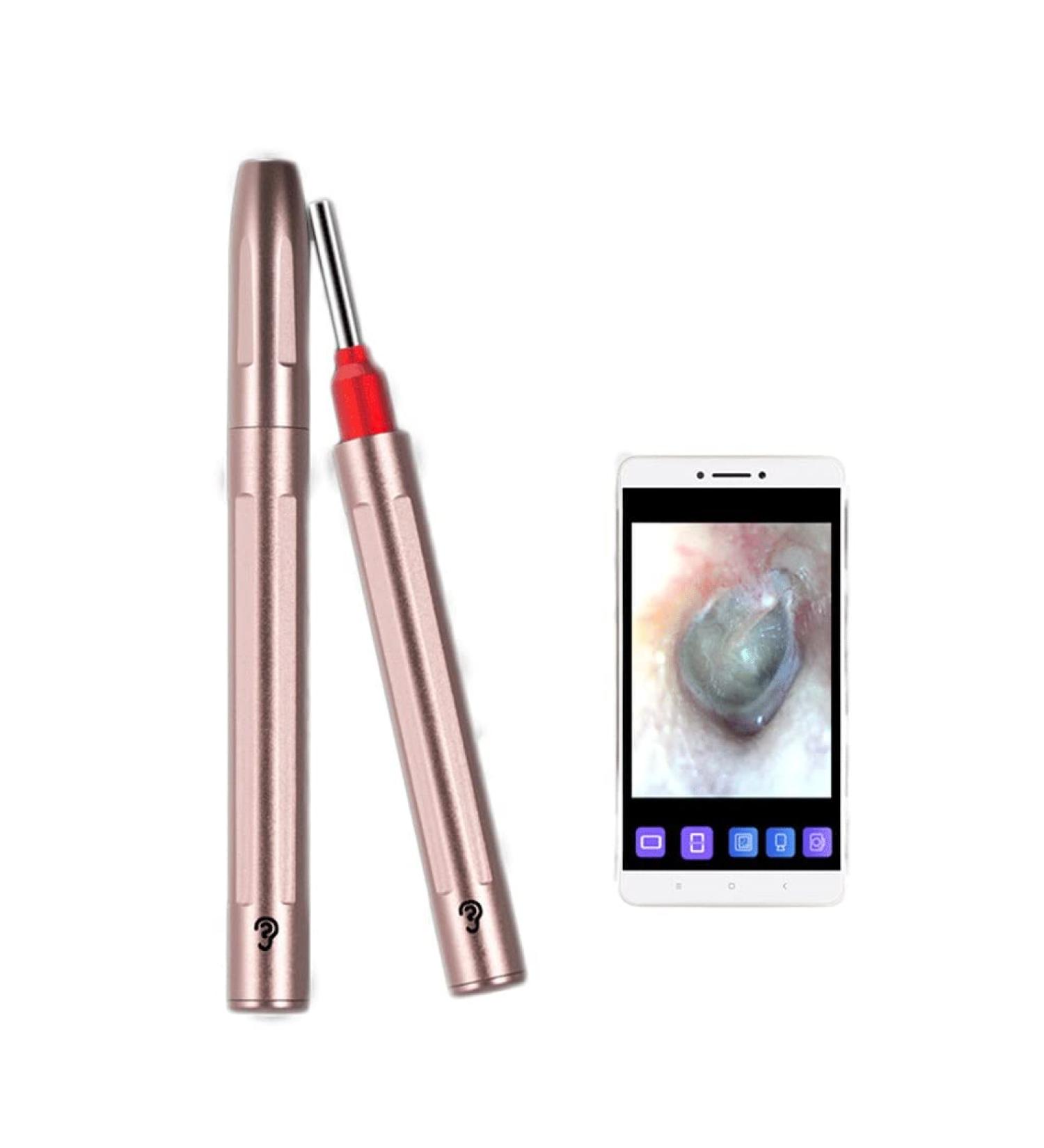 Ear Wax Removal Ear Wax Removal Tool 500W HD Wireless Ear Endoscope 3.9mm Extremely Fine Waterproof WiFi Ear Wax Removal Otoscope with 8 LED Light Compatible iPhone Android Smartphones Rose Gold - Buy Online on GoSupps.com