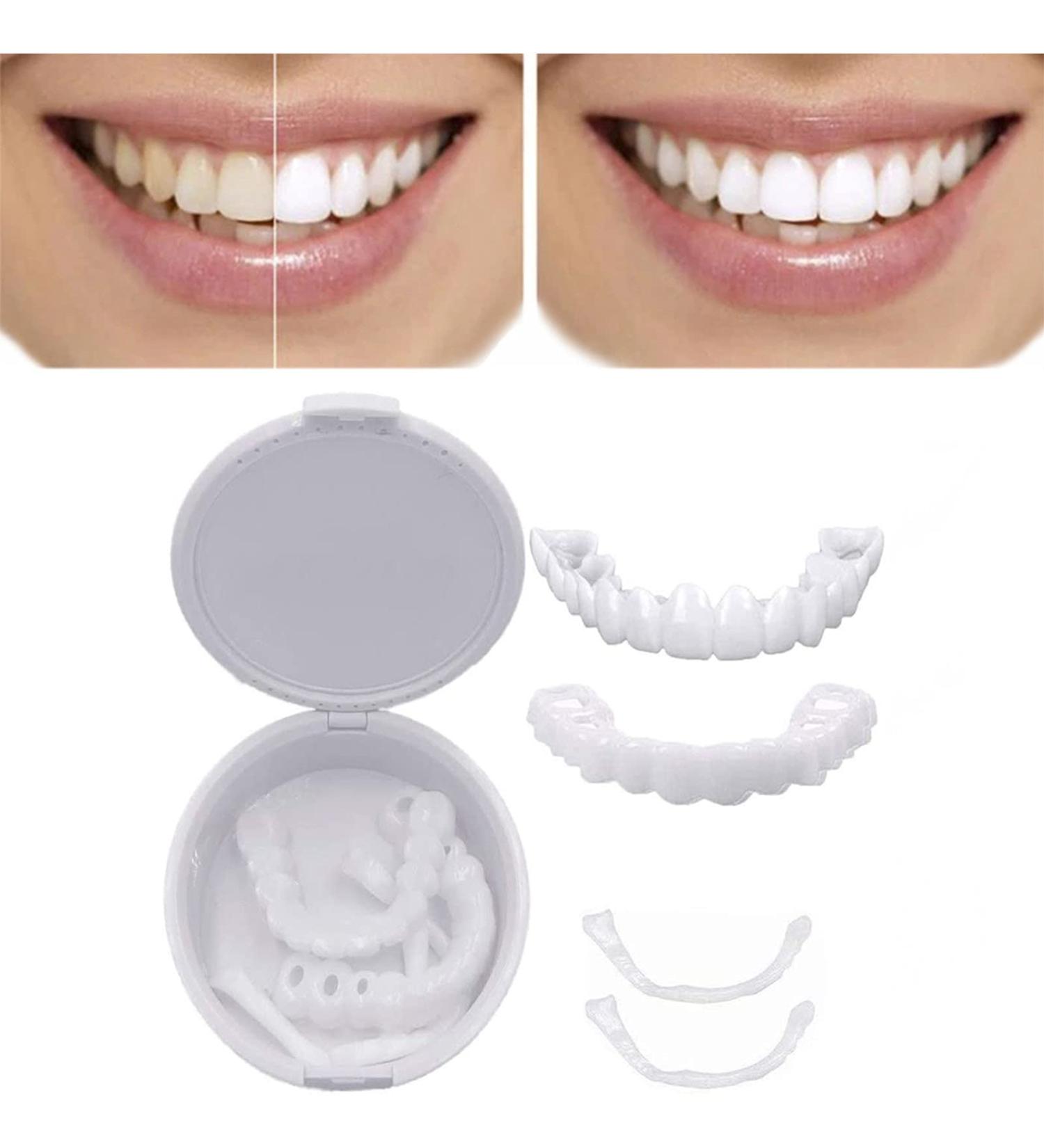 Brigtviee Protheses Teeth - 2 Pairs of Artificial Cosmetic Veneers for Men & Women | Provisional Dentures & Instant Smile Solutions - Buy Online on GoSupps.com