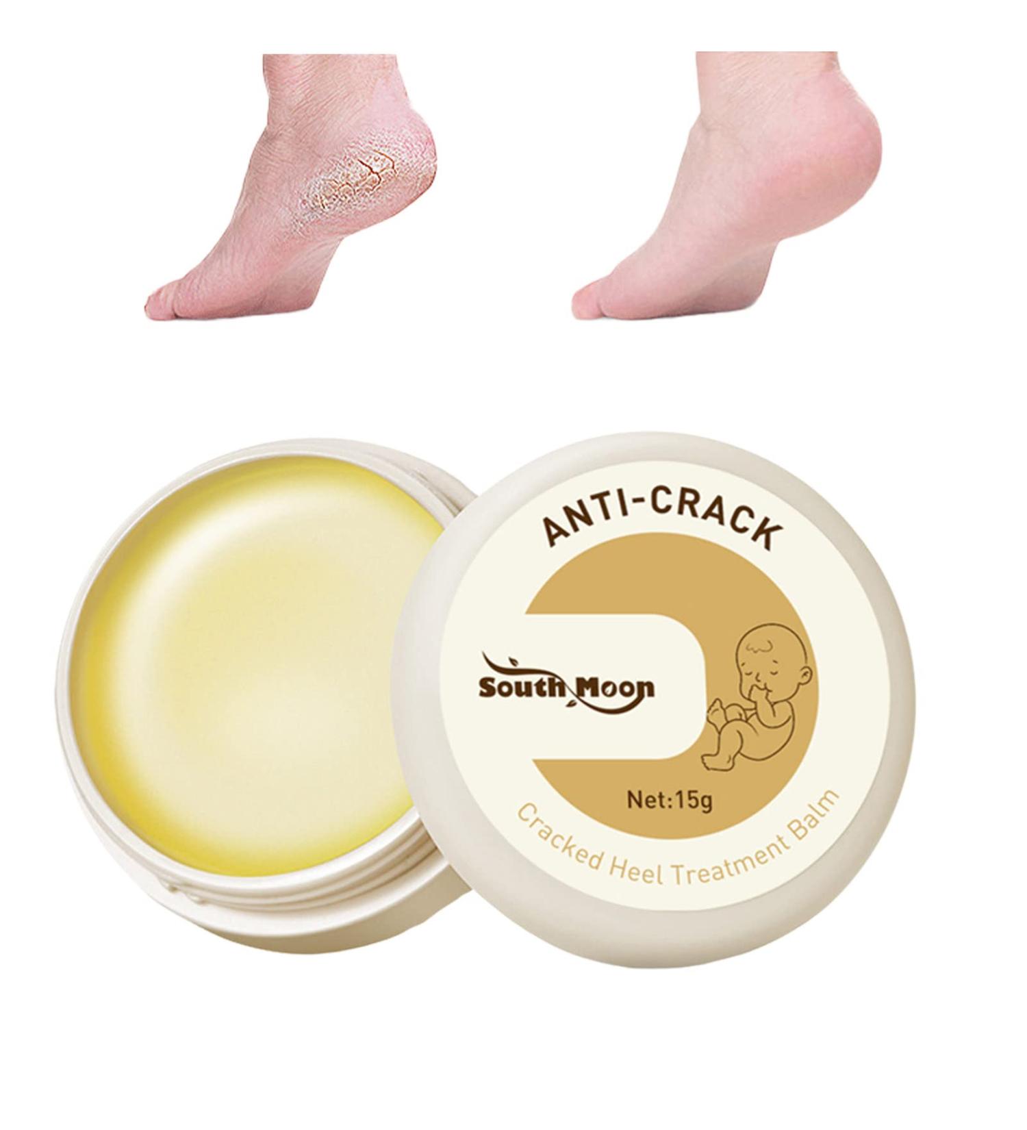 Dry Creme and Damage Creme Repairing Feet Cream Anti-Tearing for Winter Feet Anti-Crack Anti-Crack Anti-Calluses for Heel Feet 15 g - Buy Online on GoSupps.com