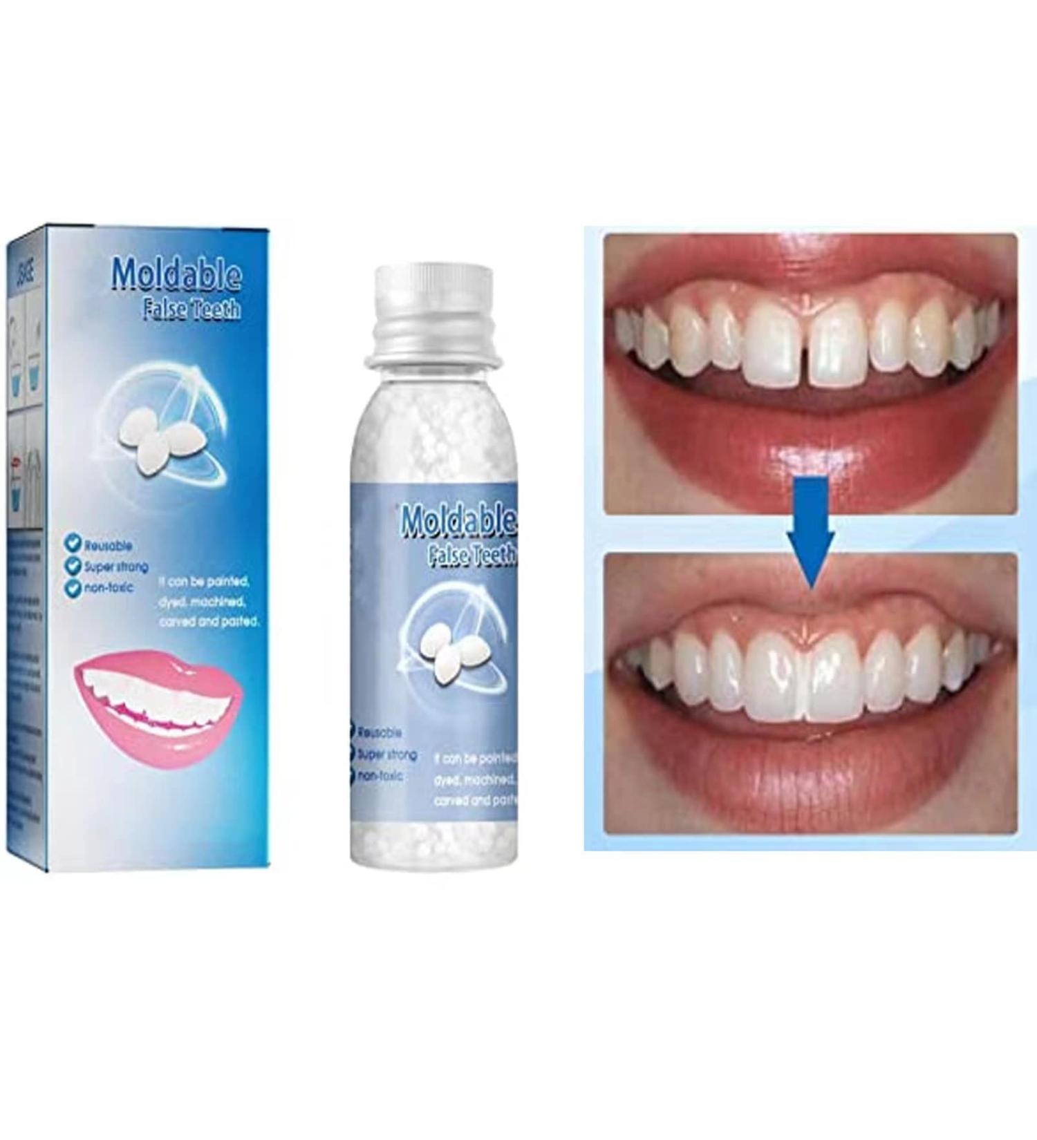 Tooth Repair Granulate - Temporary Tooth Repair Set for Missing & Broken Teeth | 10 ml - Buy Online on GoSupps.com