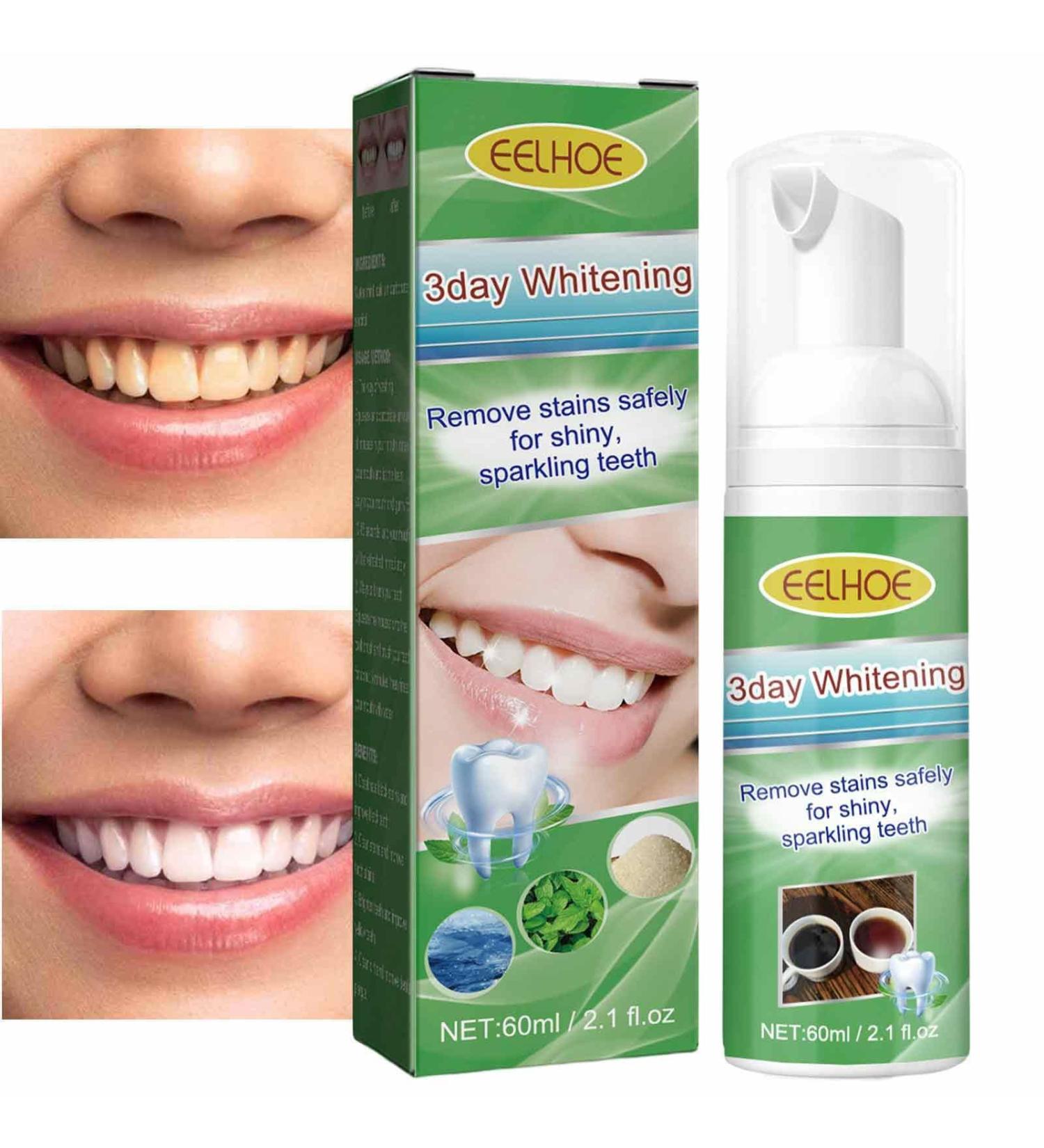 Yunmiao Teeth Whitening Mousse | Ultra-Fine Teeth Whitening Mousse 60ML Whitening Mousse Toothpaste Deep Cleaning Gums Mousse Stain Removal - Buy Online on GoSupps.com