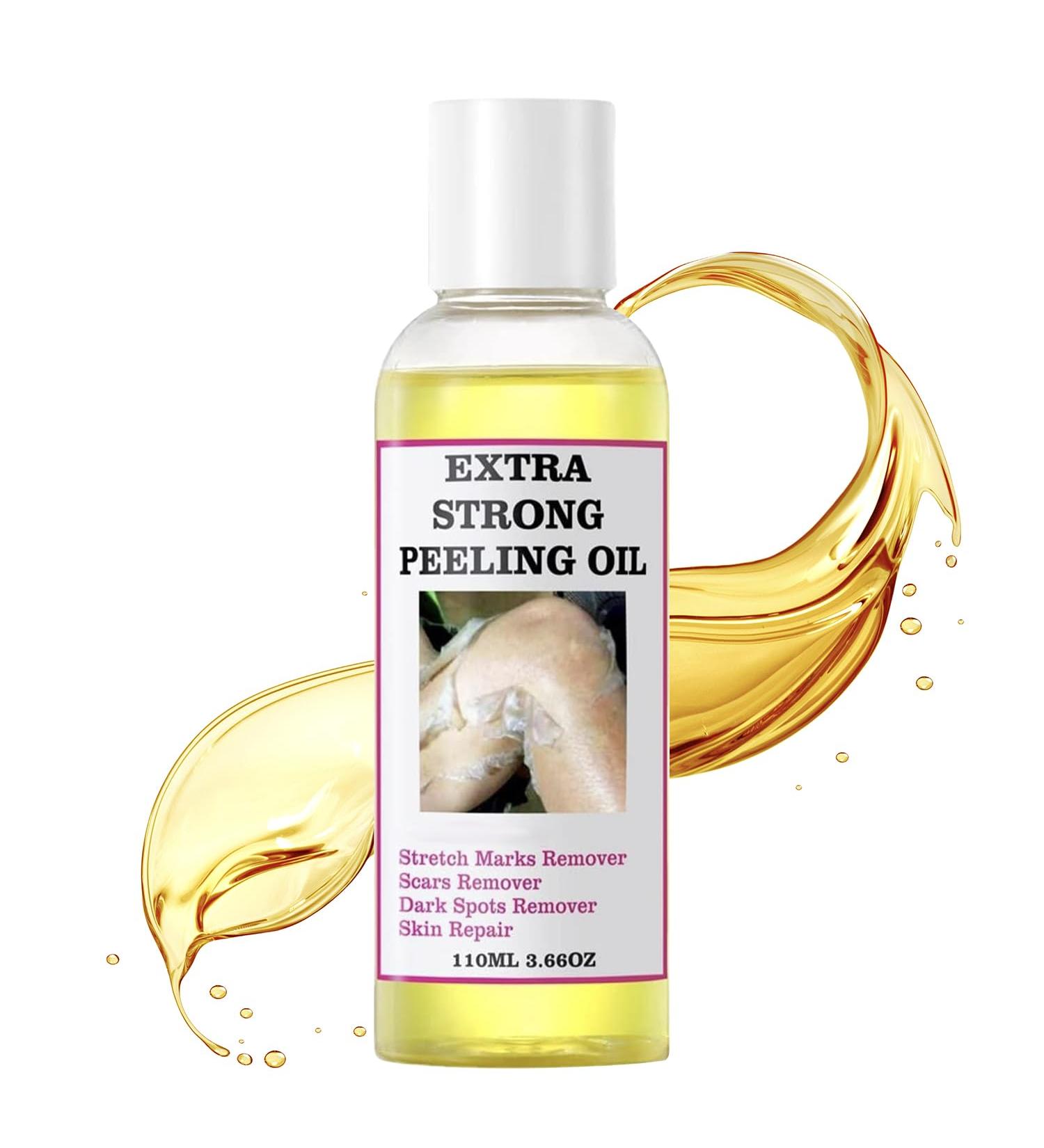 Chemical Peel for Face - Peeling Oil for Facial & Body Exfolianting with 16% Salicylic Acid - Dead Skin Remover with Gentle Formula for All Skin Type - 110mL(3.66OZ) - Buy Online on GoSupps.com