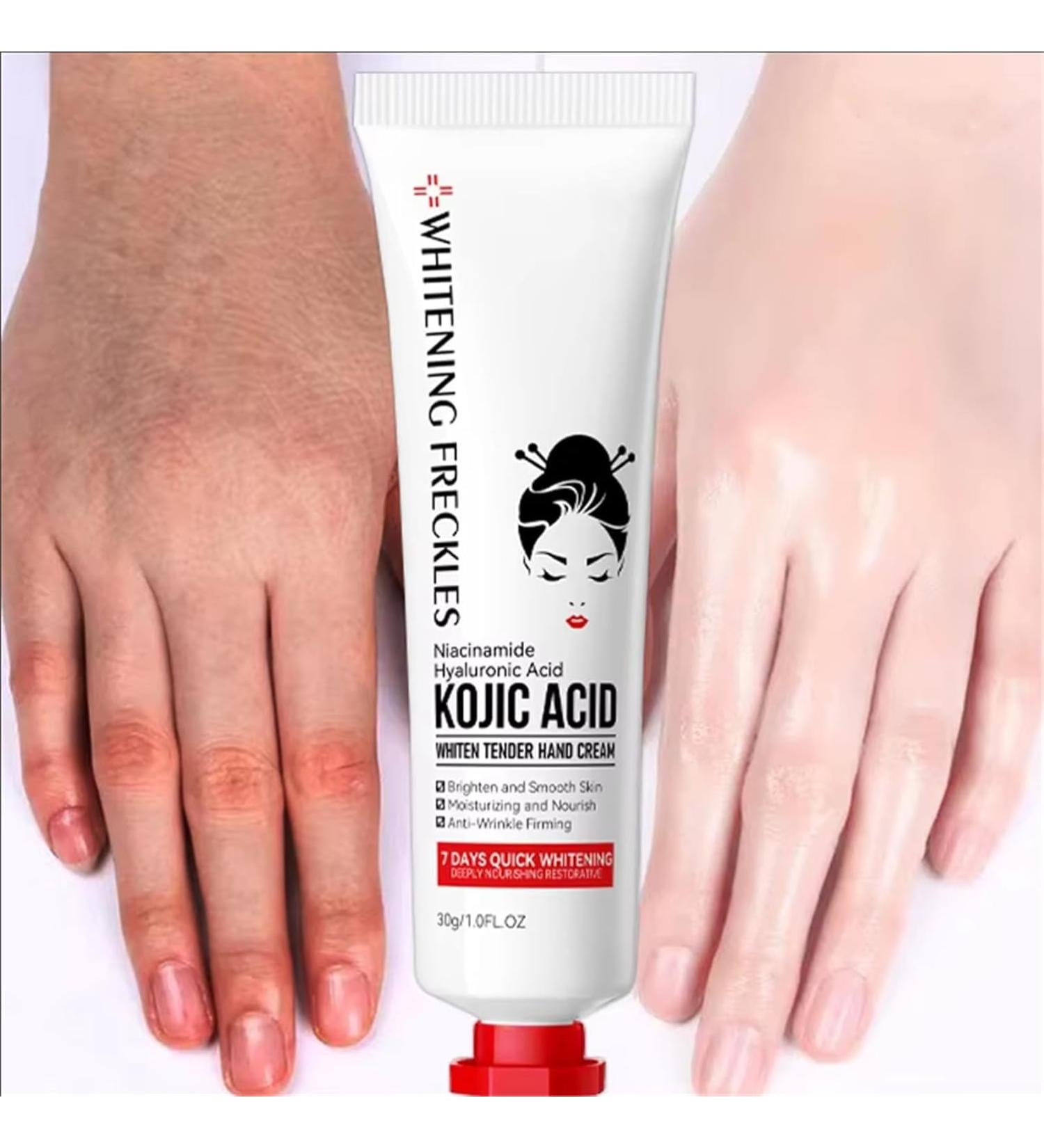 Kojic Acid Hand Cream Kojic Acid Cream Kojic Acid Cream for Hands Moisturizing Nourishing Hydrating Hand Creams Improve Dry Smoothing Skin Beauty Hands Winter Skin Care (1) - Buy Online on GoSupps.com