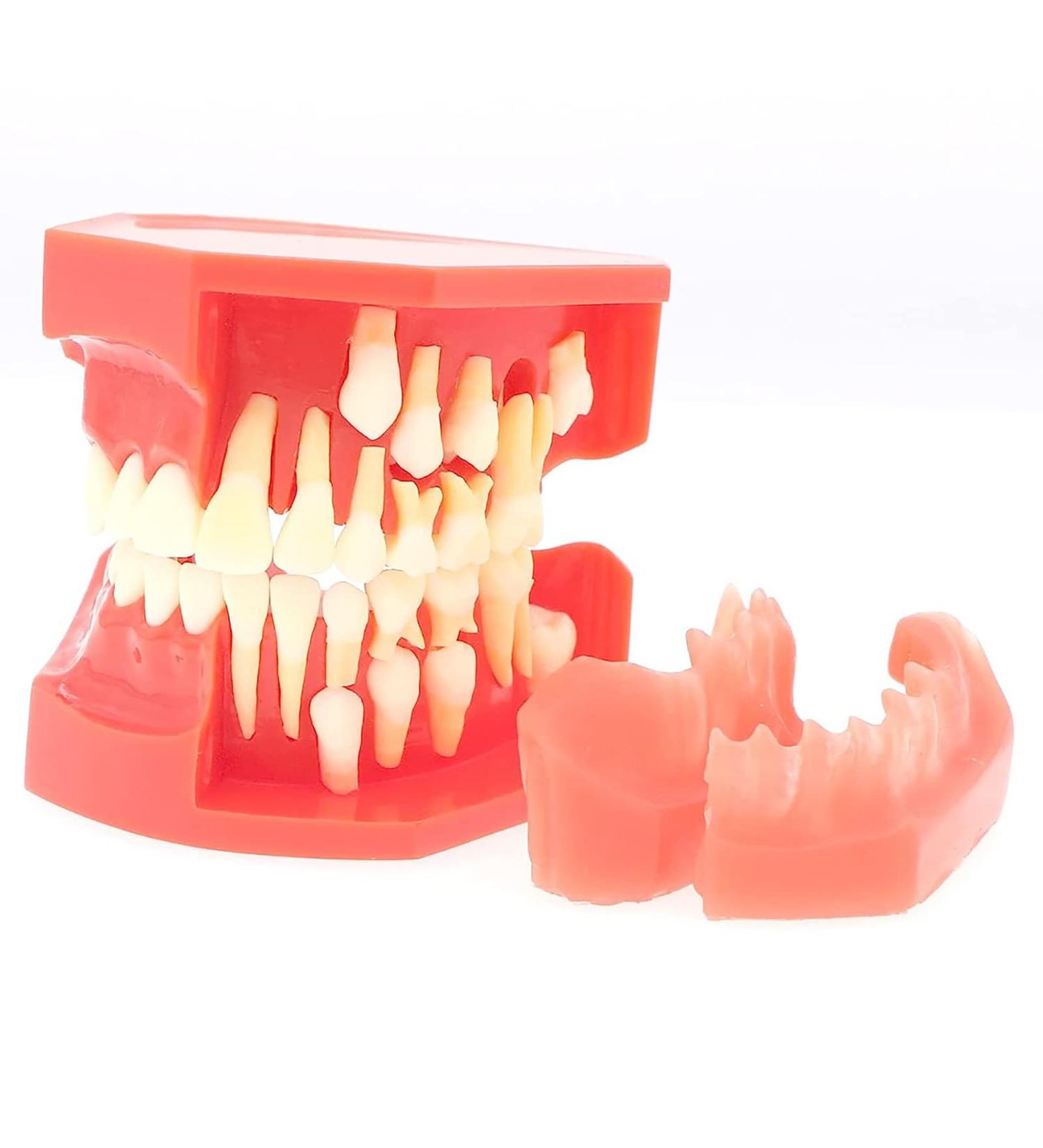Lmeil Silicone Tooth Development Model for Children | Milk Teeth & Deformality Education Tool - Buy Online on GoSupps.com