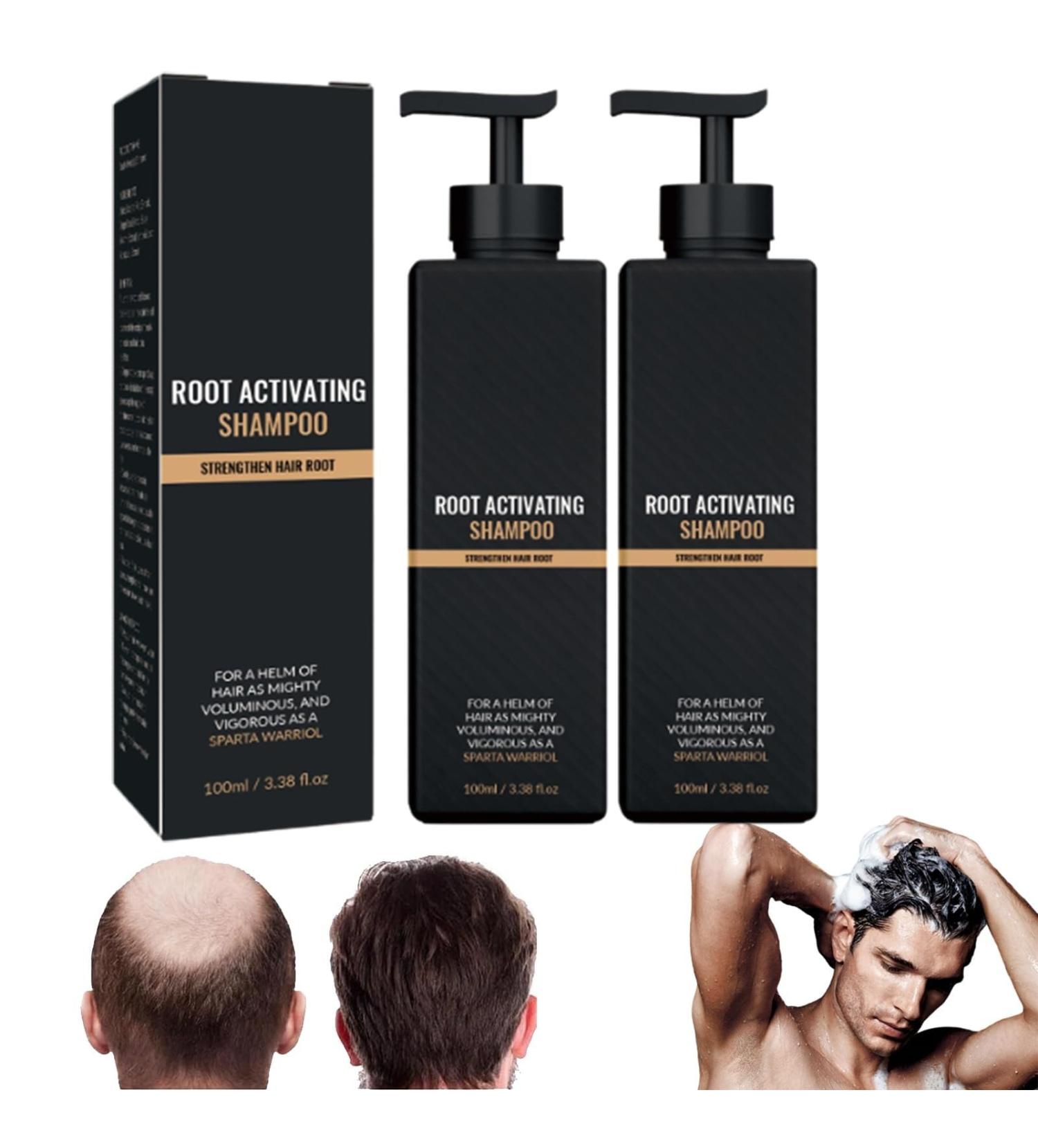 Root Activator Shampoo Hair Shampoo That Nourishes Your Scalp and Hair for Thinning Hair and Hair Loss. (2pcs) - Buy Online on GoSupps.com