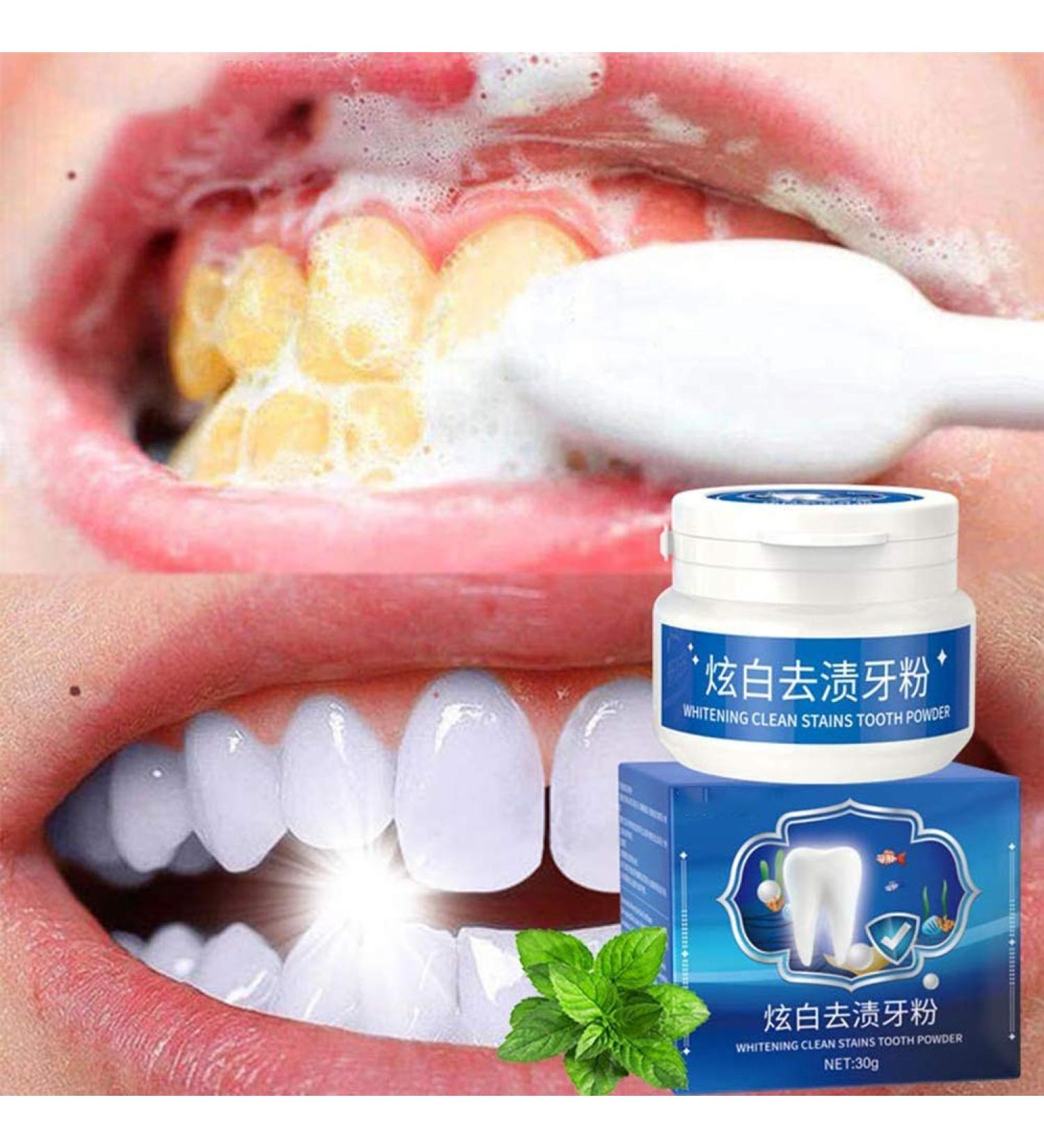 Snow Forest Tooth Elevator Powder - 30g | Remove Coffee Stains & Whiten Teeth | International Shipping - Buy Online on GoSupps.com