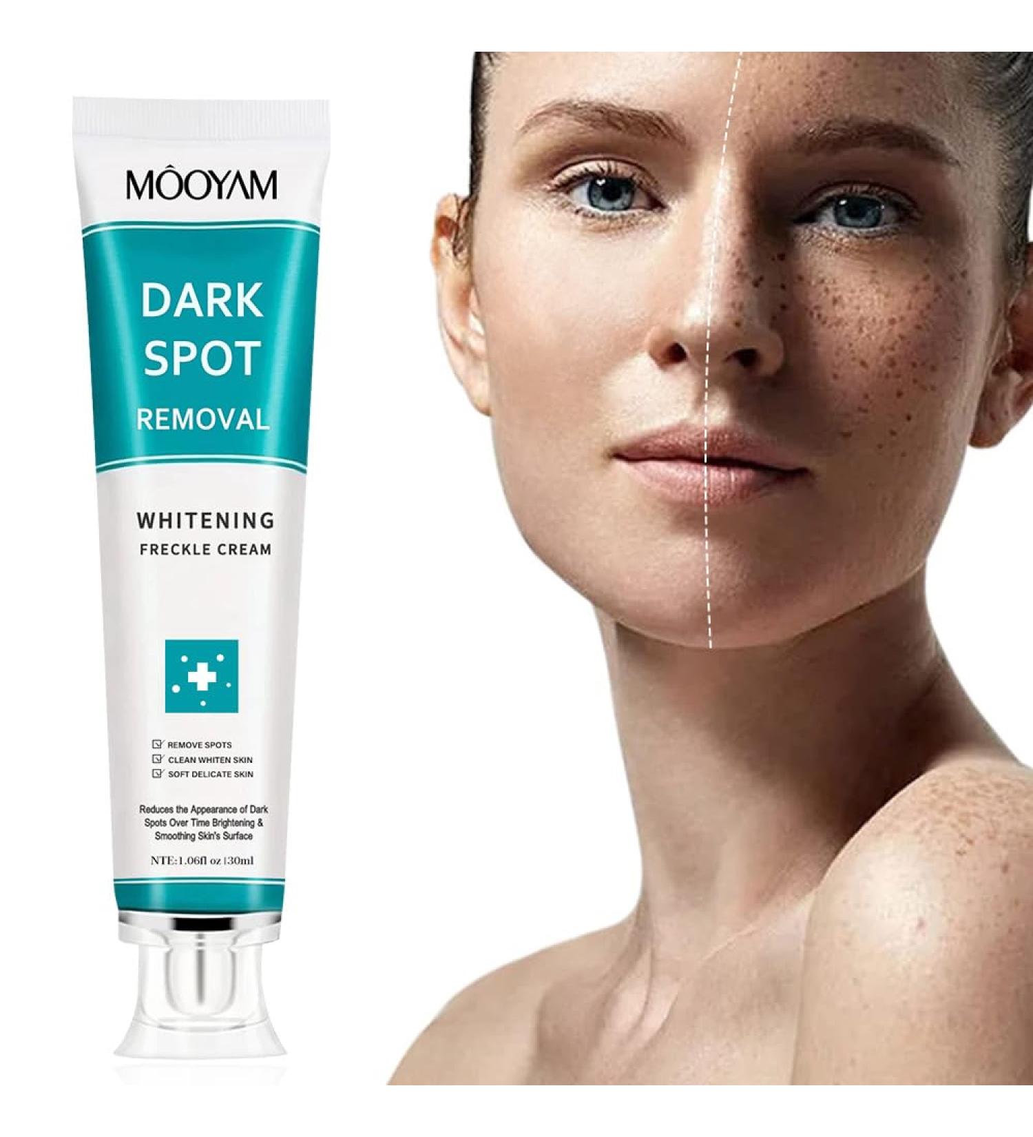 Go Ho Skin Whitening Cream | Skin Bleaching & Dark Spot Remover for Face & Body | Lightening Cream for Intimate Areas Armpits Knees & Elbows | 1.06oz - Buy Online on GoSupps.com