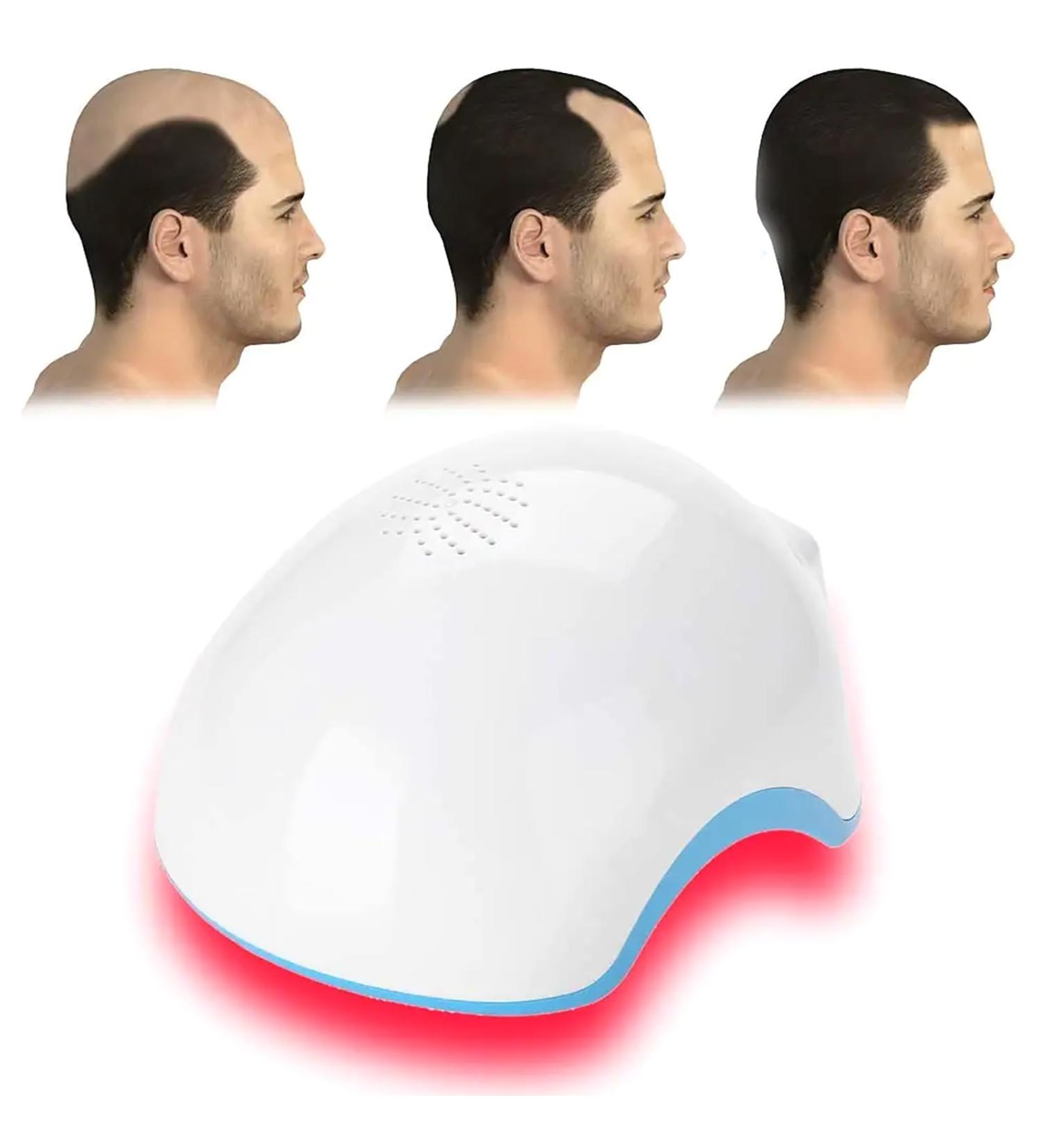 Casque De Traitement pour La Repousse des Cheveux Chapeau De Th rapie Contre La Perte De Cheveux avec 62 Points D'irradiation LED Couvrant Tout Le Cuir Chevelu R gule La S cr tion D'huile - Buy Online on GoSupps.com