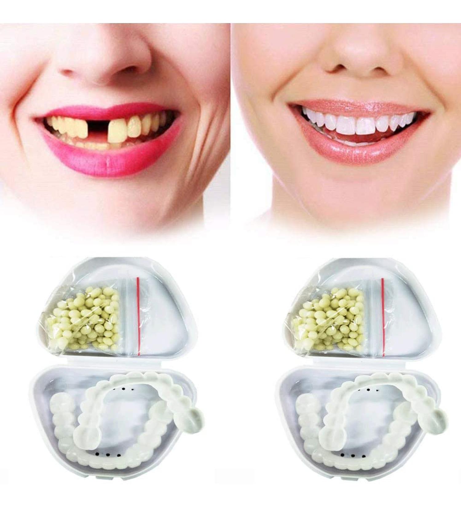 Fausses Dentaire Fausses Dents Les Placages S'enclenchent Dentier Amovible Haut Et en Bas pour Hommes Femmes Placages De Dents pour Dents Manquantes 2 Pairs - Buy Online on GoSupps.com
