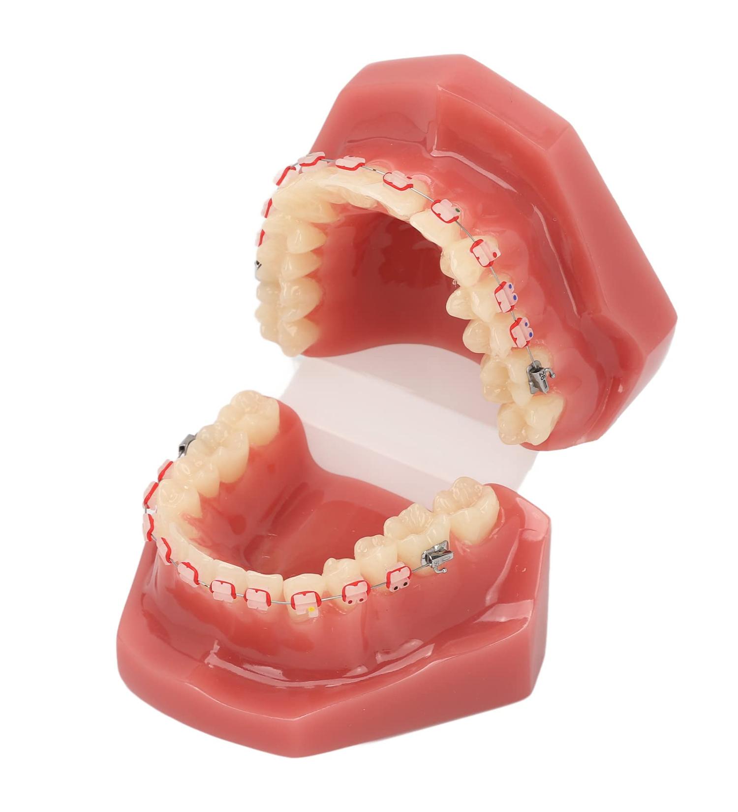 Orthodontic Demonstration Model for Dental Research | Metal Wires & Ceramic Brackets | Teaching Aids for Adults - Buy Internationally - Buy Online on GoSupps.com