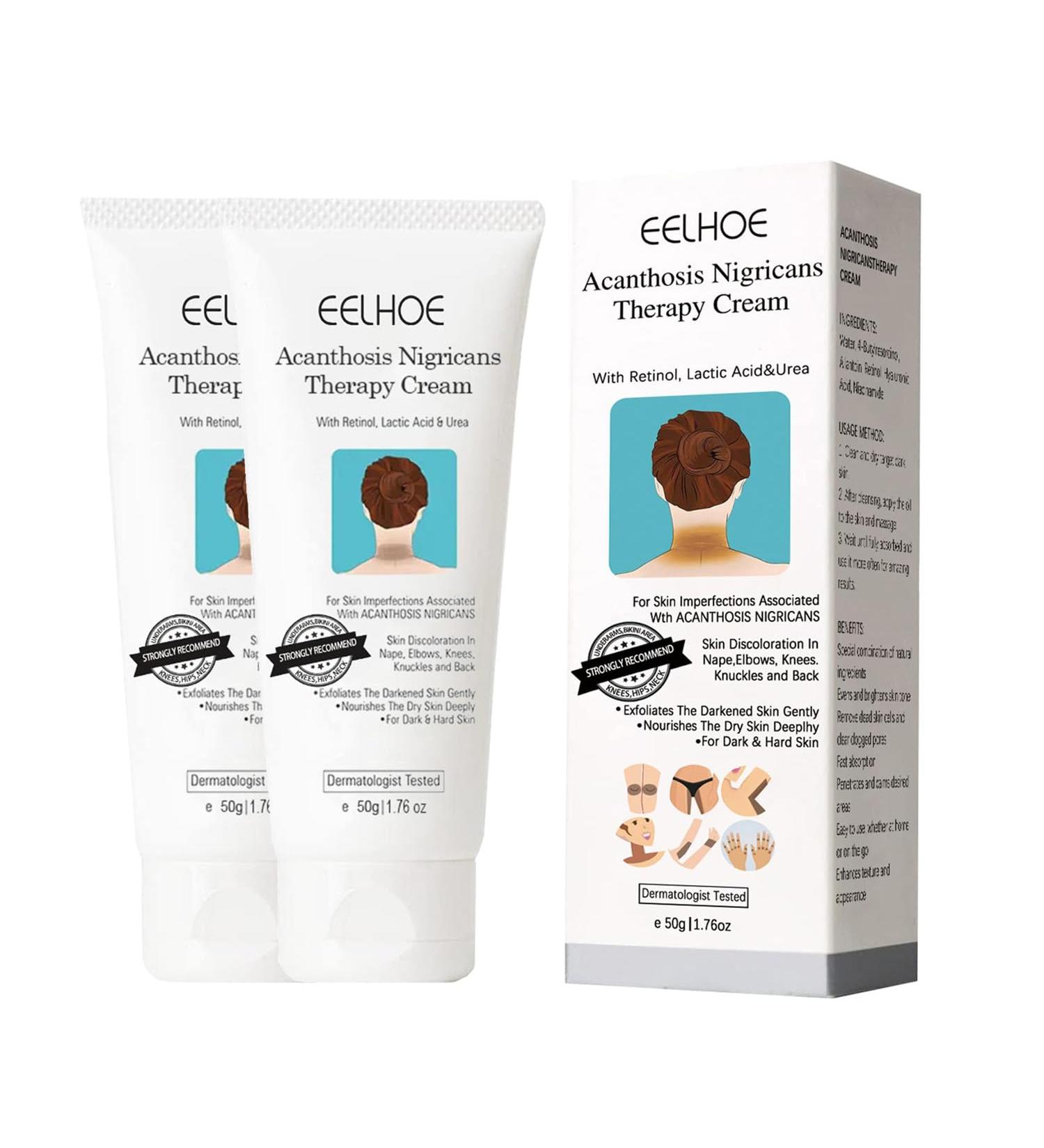 Nigrifree Acanthosis Nigricans Cream Acanthosis Nigricans Cream Lactic Acid Retinol Nigrifree Cream Brightening Face Cream Body Cream Correcting Dark Spots (50g (bottle of 2)) - Buy Online on GoSupps.com