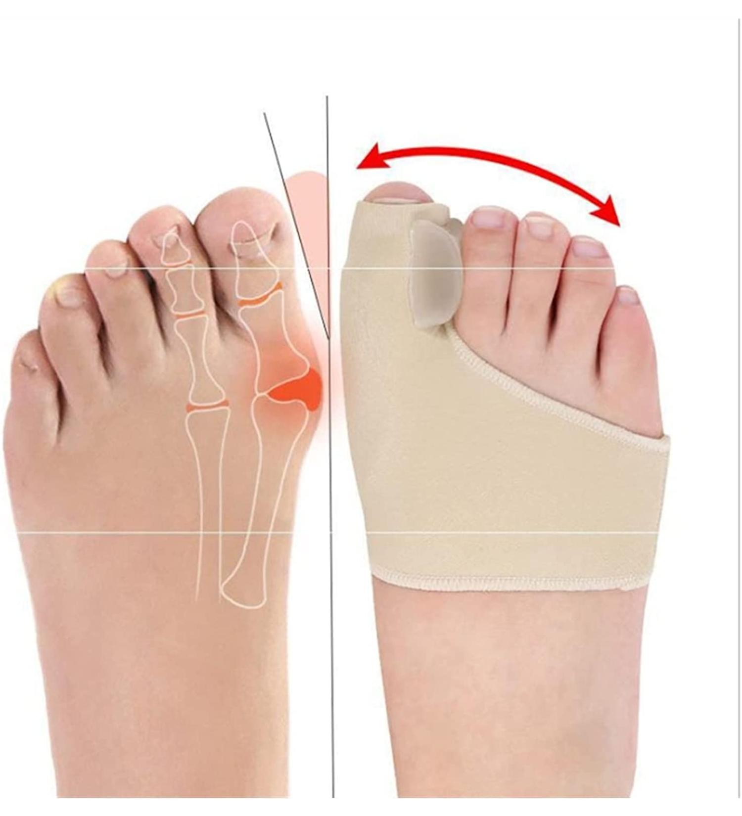 Jinlingnb Toe Spreader for Hallux Valgus | Bunion Splints & Foot Care Tool - Corrector & Protector - Buy Online on GoSupps.com