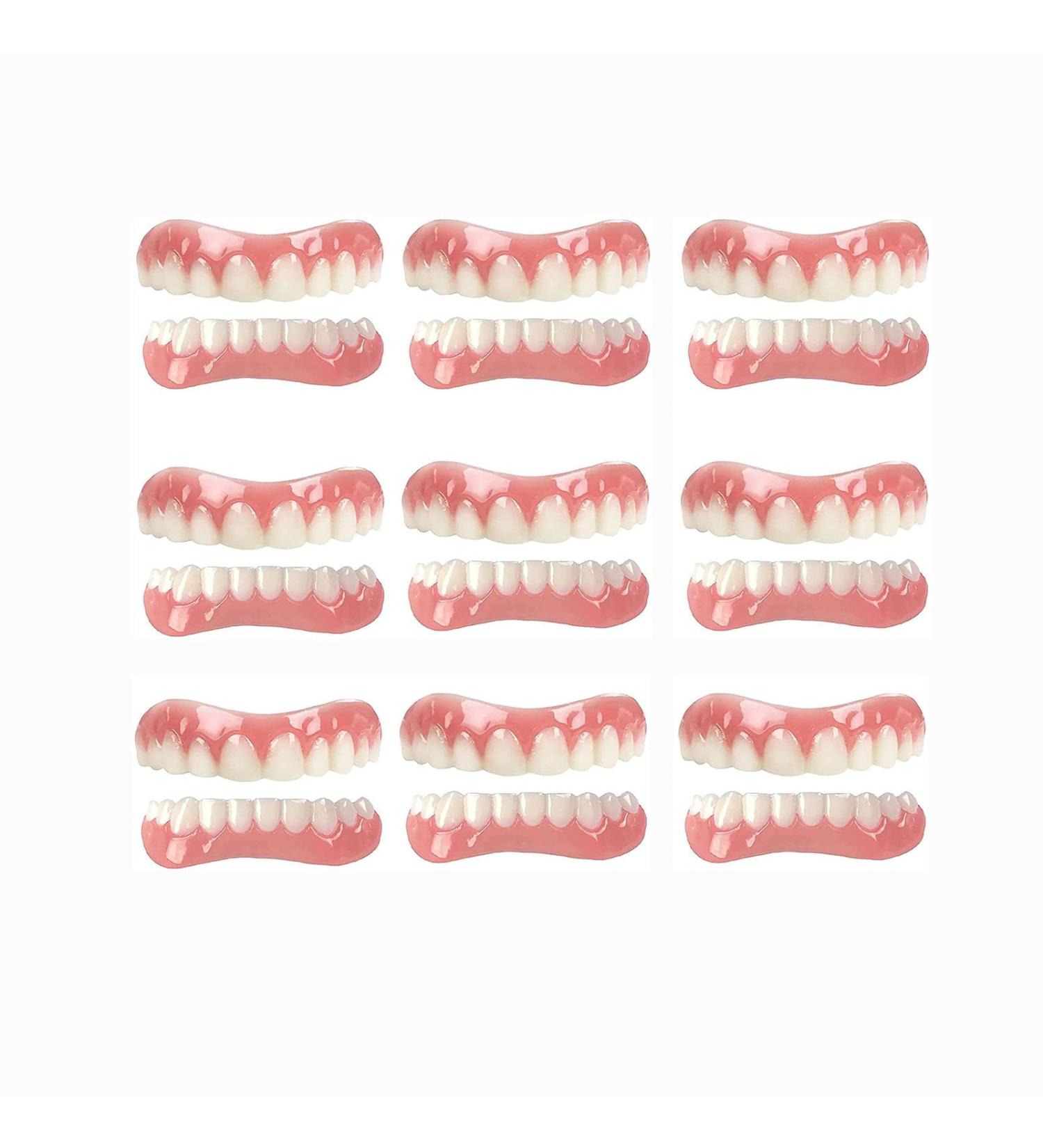 9-Piece Instant Veneers Dentures & Tooth Repair Kit for Chipped Teeth - Snap-On Solution for Missing Teeth, Gap Filling & Denture Care - Buy Online on GoSupps.com