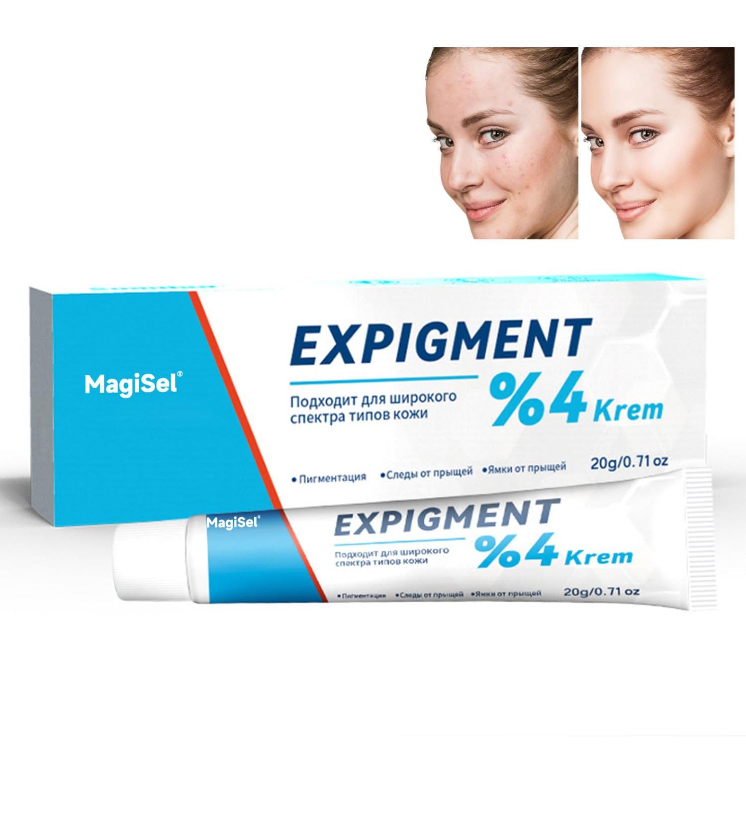  MagiSel Facial cream for acne-prone skin plant-based anti-blemish cream 20g moisturizing face cream hydrates and leaves skin feeling smooth gentle formula - Buy Online on GoSupps.com