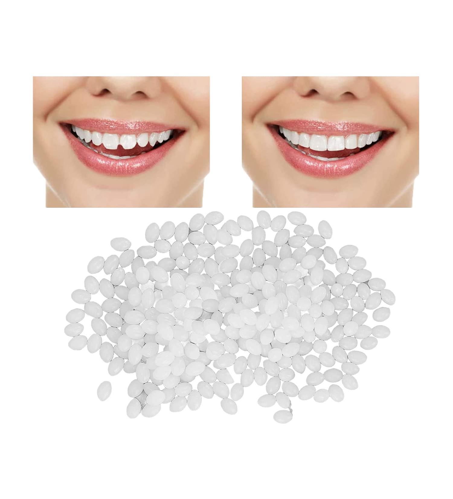 Temporary Tooth Repair Beads - 10g Teeth Filling Replacement for Chipped Teeth - Dental Tooth Filler for Missing/Broken Teeth - Buy Online on GoSupps.com
