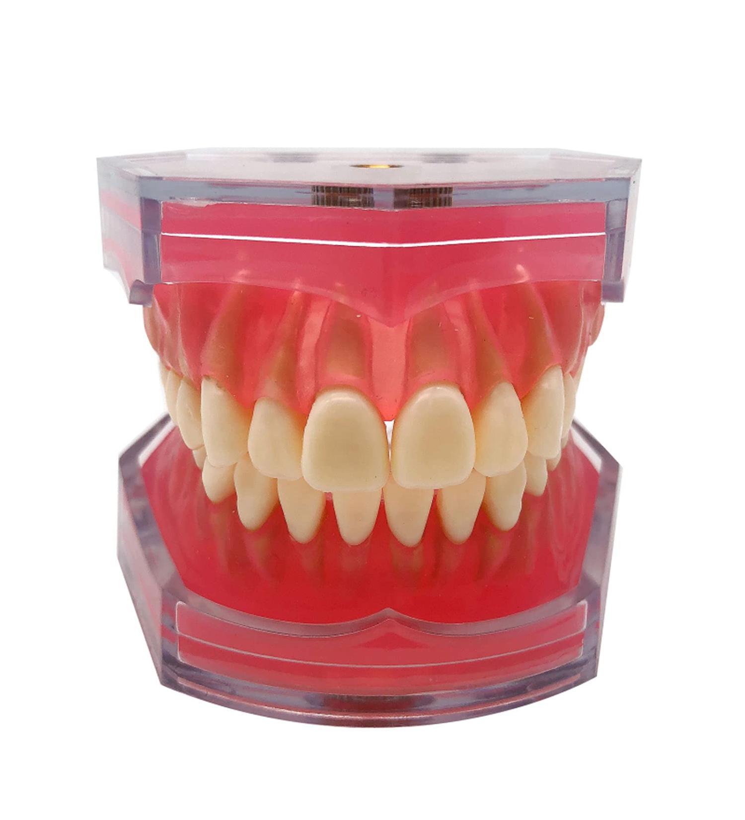 Standard Dental Teeth Model - Removable Full Mouth Resin Crown Model for Tooth Extraction & Patient Explanation - Buy Online on GoSupps.com