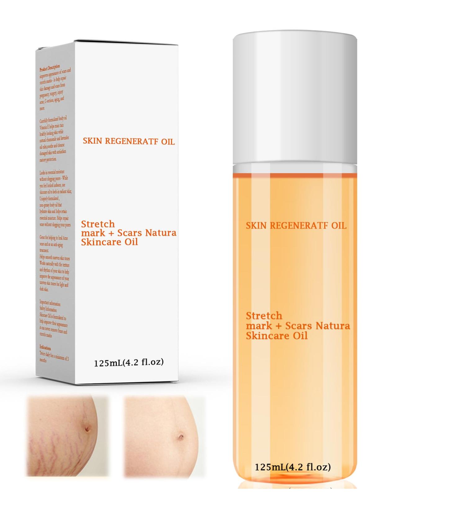 Emollient Oil Precious Oil for Soothing Moisturizes Face and Body Care 125 ml Skin Care Oil for Dry Skin Stretch Marks Scars - Buy Online on GoSupps.com