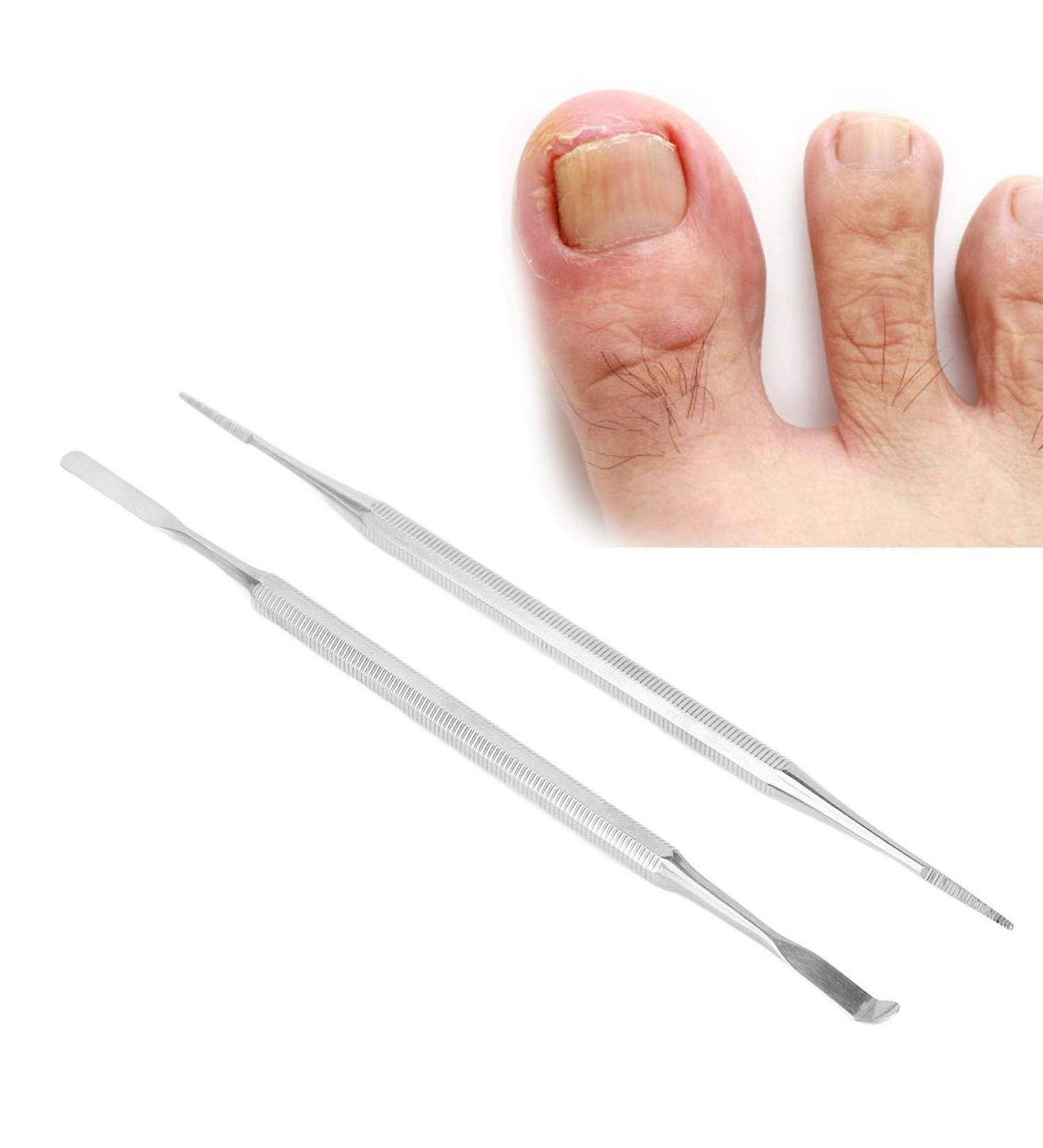 Ingrown Toenail Tool Kit | Professional Stainless Steel Nail File & Lifter Set | Pedicure Essential for Nail Care - Buy Online on GoSupps.com