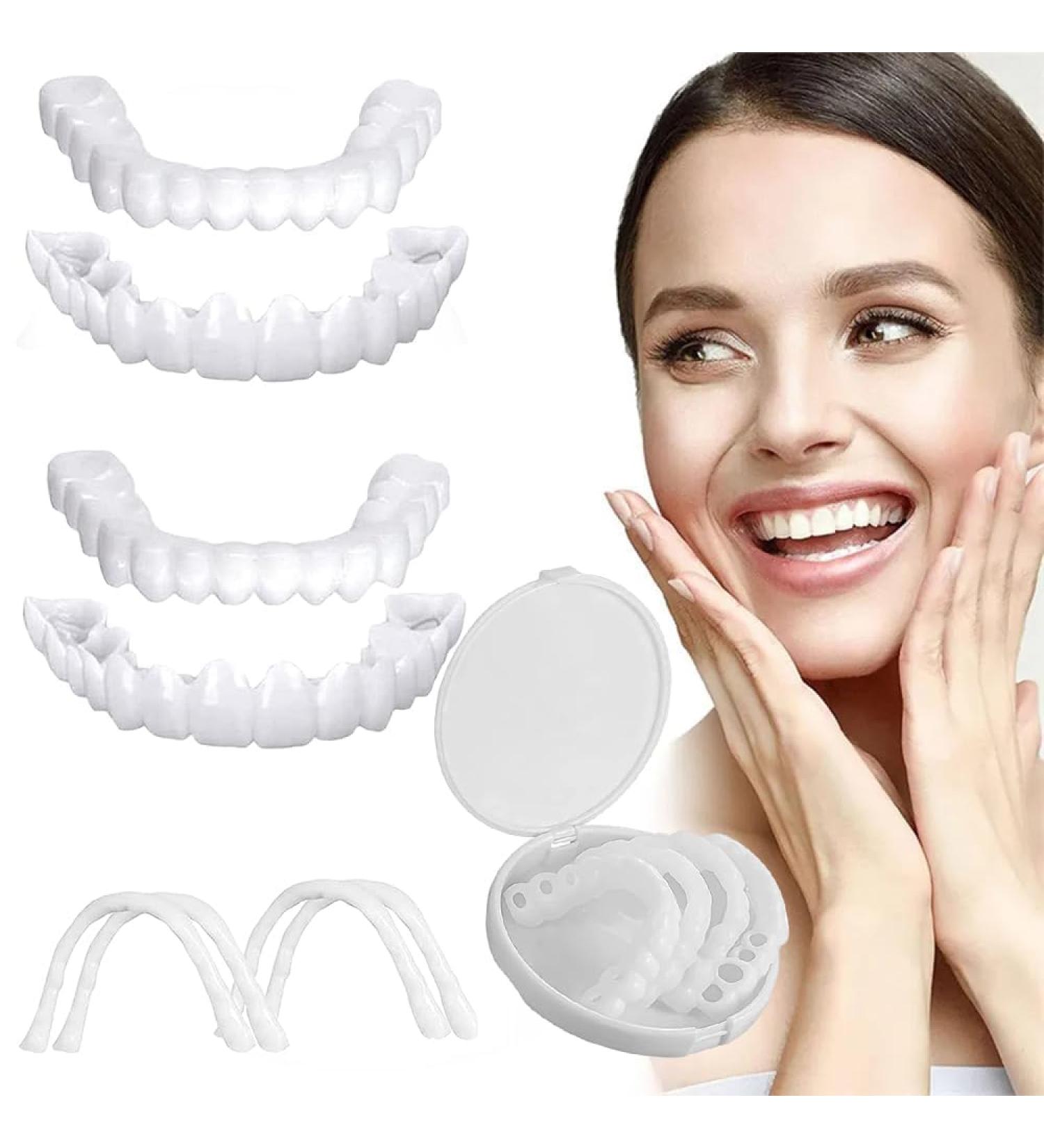Frenzify Dental Prosthesis Tooth Bleaching Set - Cosmetic Veneers for Upper & Lower Snap-On Dentures | Perfect for Men & Women with Bad Teeth - Buy Online on GoSupps.com