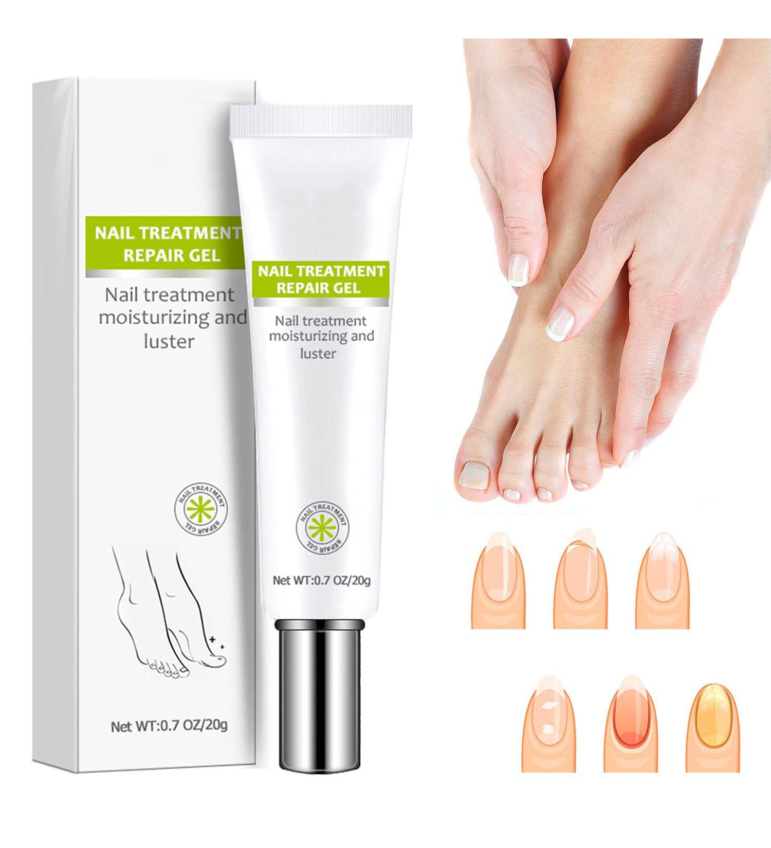 Nail Repair Treatment Gel - Instantly Renew Yellow, Cracked Nails - Buy Online on GoSupps.com