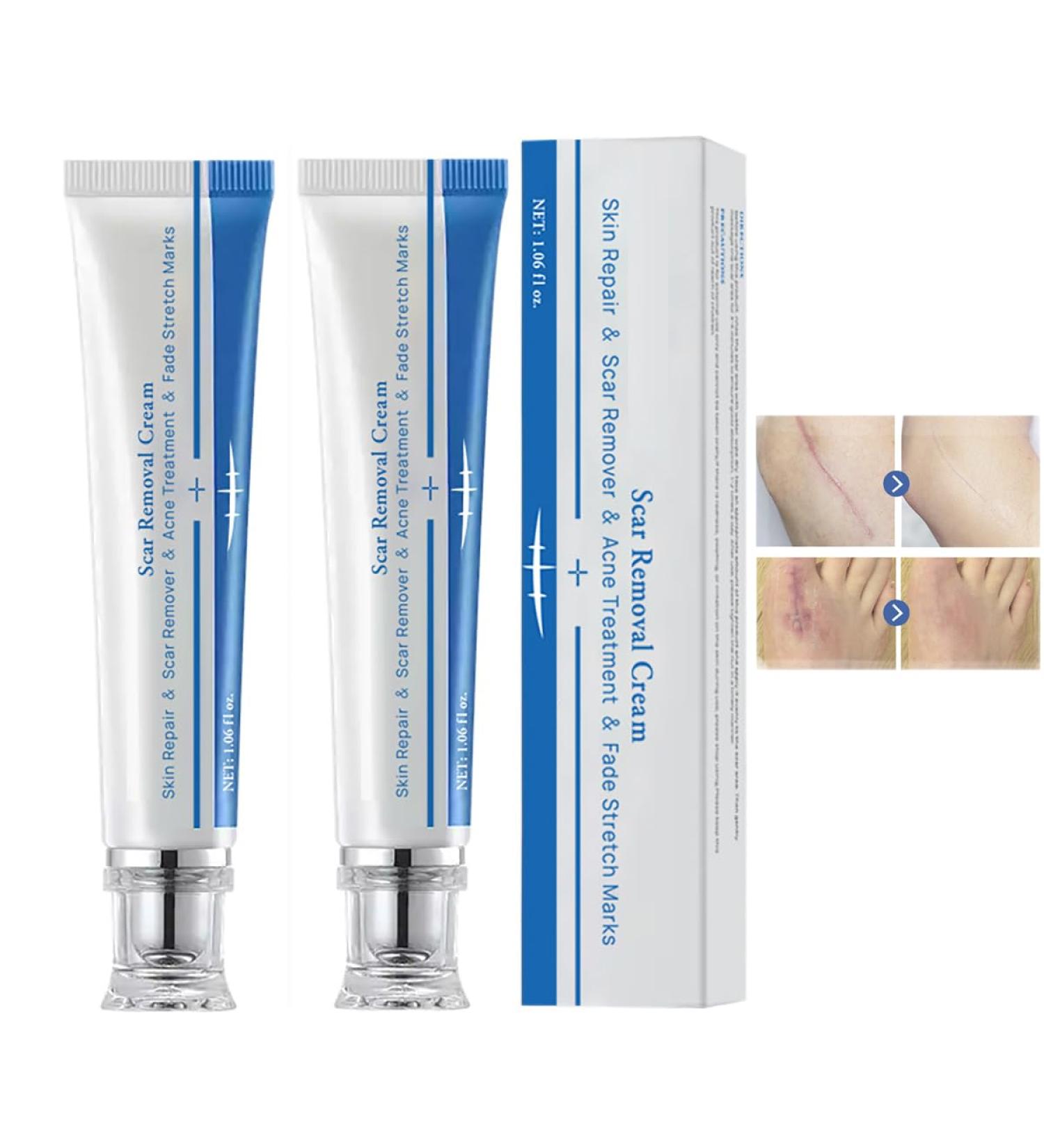  ZRREMRE Anti Scar Cream Repair Gel for Old and New Scars Face Scar Treatment Cream Surgical Scars Acne Scars Caesarean Section  - Buy Online on GoSupps.com