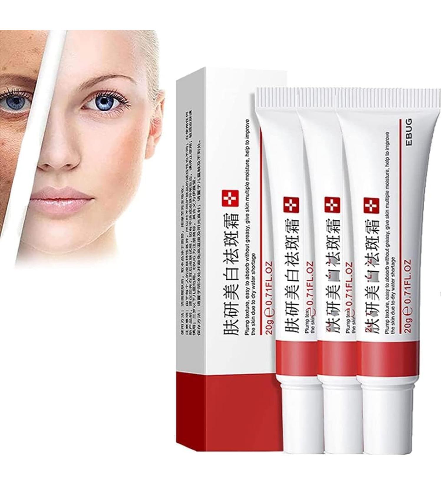 SGHOPLG 3Pcs Effective Whitening Freckle CreamRemove Melasma Acne Cream Fading Spot CreamAcne Scar Removal TreatmentFade Pigmentation Anti Melasma Brighten Skin Care Creams - Buy Online on GoSupps.com