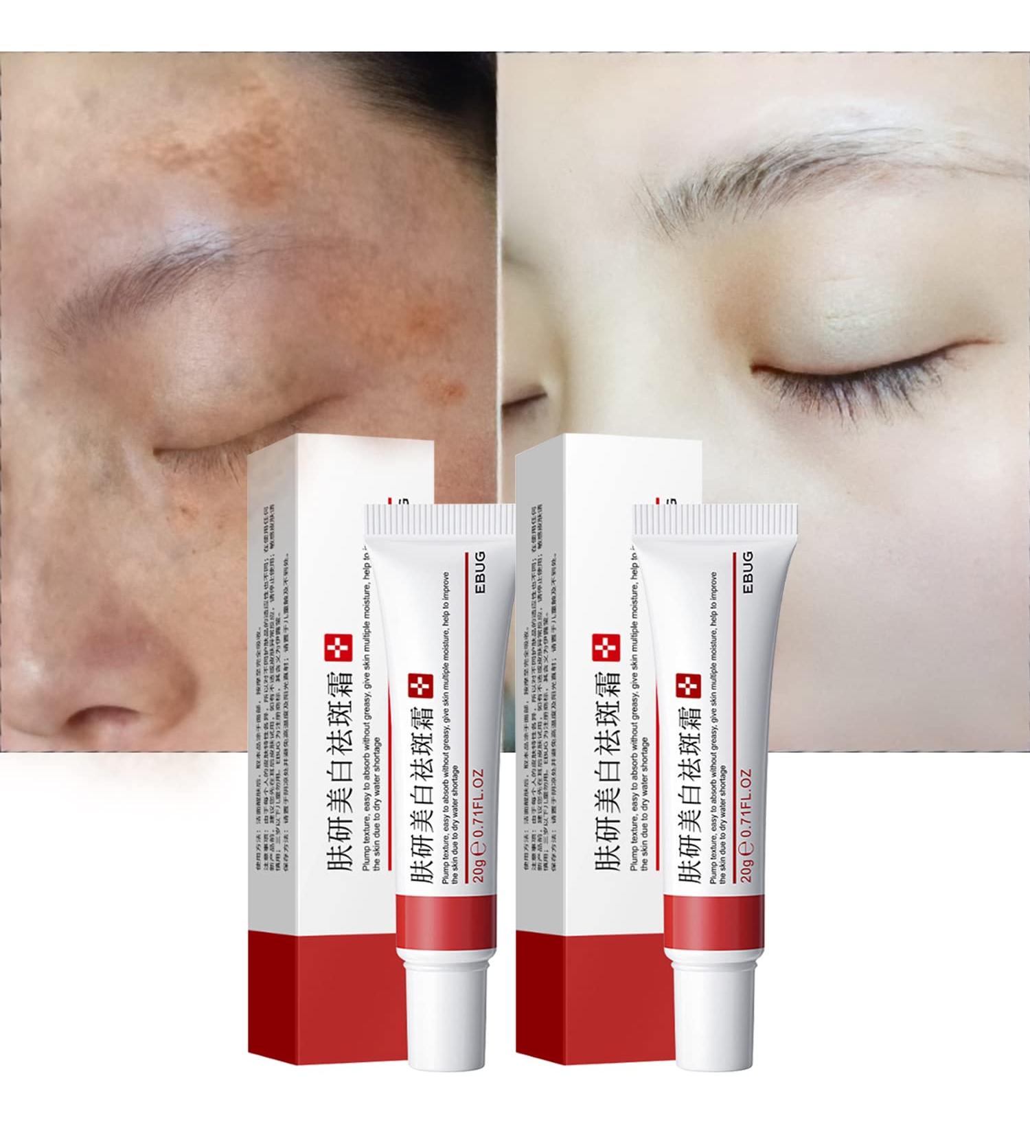 Dark Spot Remover Cream with Alpha Arbutin, Niacinamide, Collagen - for Face, Body & Sensitive Areas- Vitamin E, Bearberry, Vitamin A- Age & Sun Spot Corrector - Buy Online on GoSupps.com