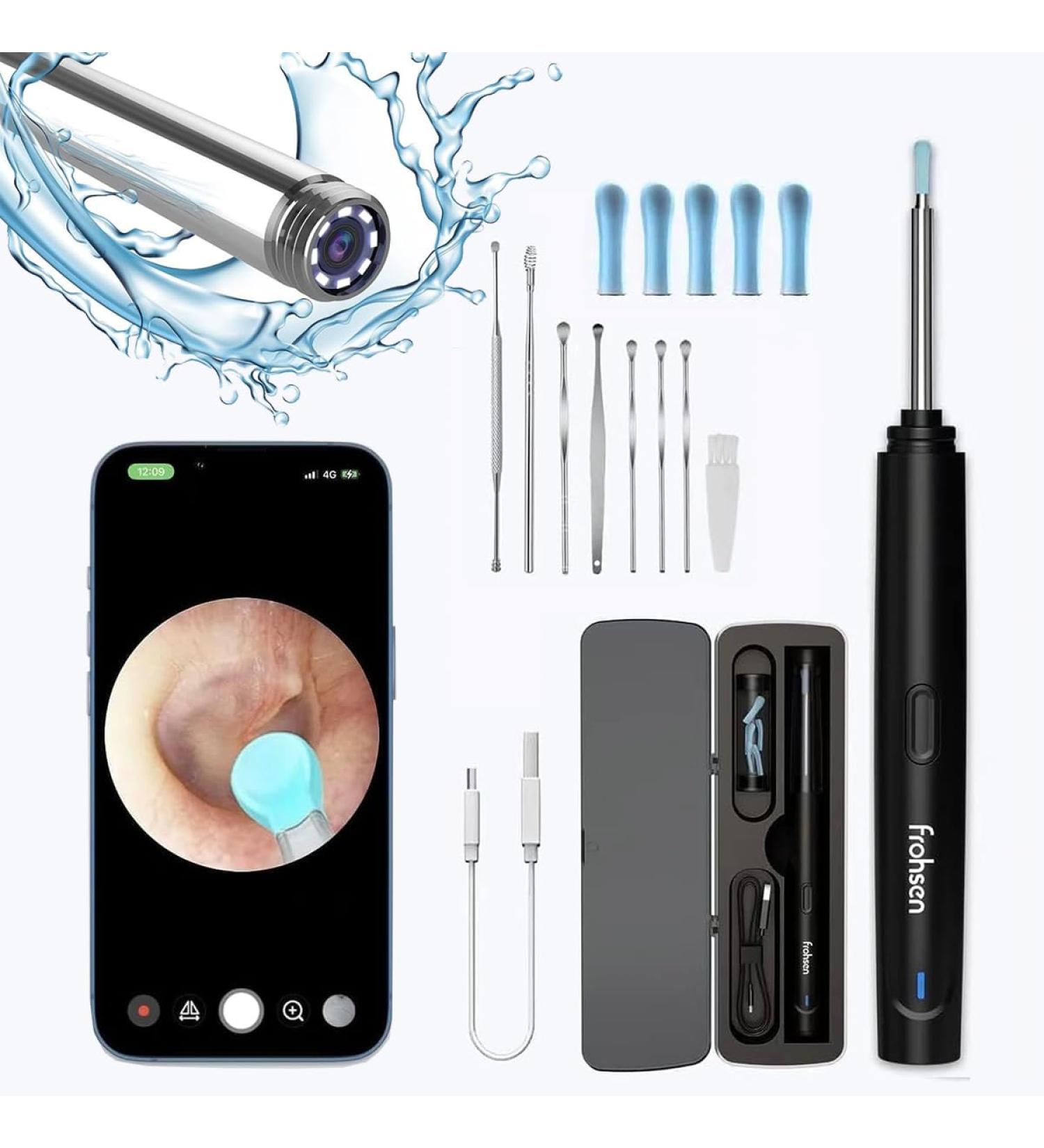 Frohsen Ear Wax Removal Kit Otoscopes Visual Smart Ear Cleaner with Real Time HD Camera Light Ear Scope Cleaning Kits Ear Wax Remover iOS & Android Systems Supported - Buy Online on GoSupps.com