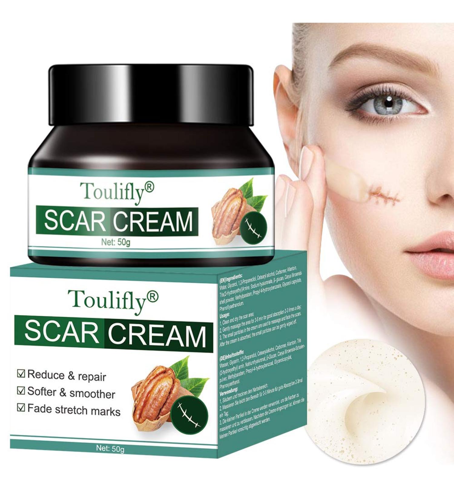 Scar Cream Anti Acne Cream Scar Cream Anti Stretch Mark Cream Remove Scar Cream Dispel Scar Scar Spots Blemish Points 50g - Buy Online on GoSupps.com