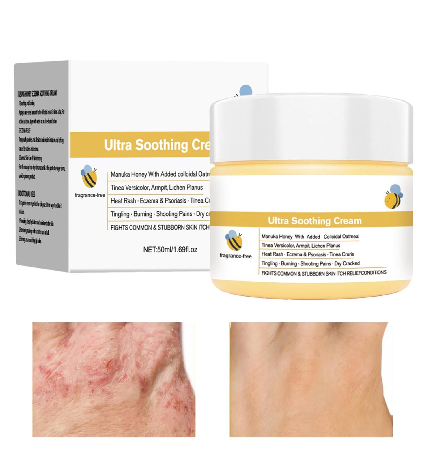 Soothing Moisturizing Cream 50ml Natural Moisturizing Lotion for Skin Anti-Itch Care | for Dry Skin Redness and Itching Soothing and Nourishing and - Buy Online on GoSupps.com