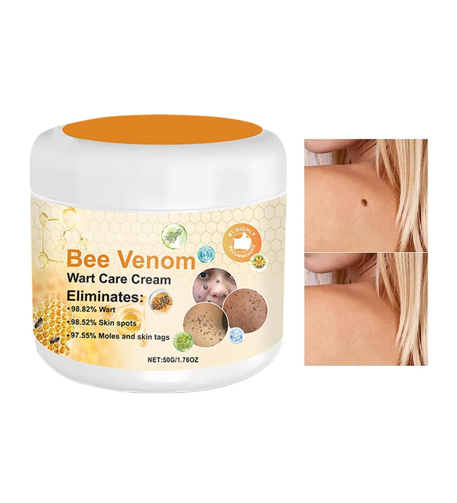 Bee Venoms Wart and Tag Remover - Bee Venoms Repair Cream - Skin Bee Venoms Tag Removal Cream - Bee Body Lotion - Tag Recede Bee Venoms Cream for All Skin - Intensive Body Lotion - Buy Online on GoSupps.com
