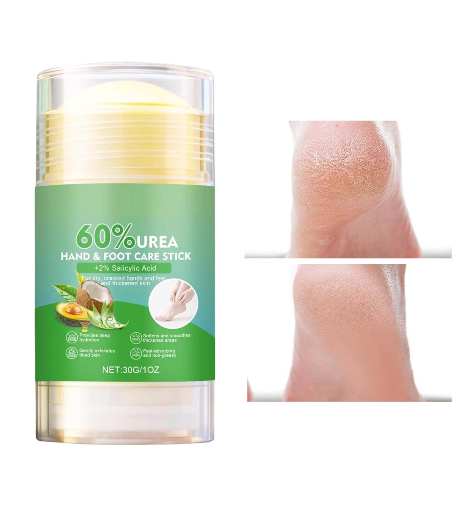  G n rique Foot Balm - Repairing Cream Stick Moisturizing for Knees for Dry Cracked Heels Rough Dead Skin Nighttime Pedicure for Hands Knees and Elbows (Women) - Buy Online on GoSupps.com
